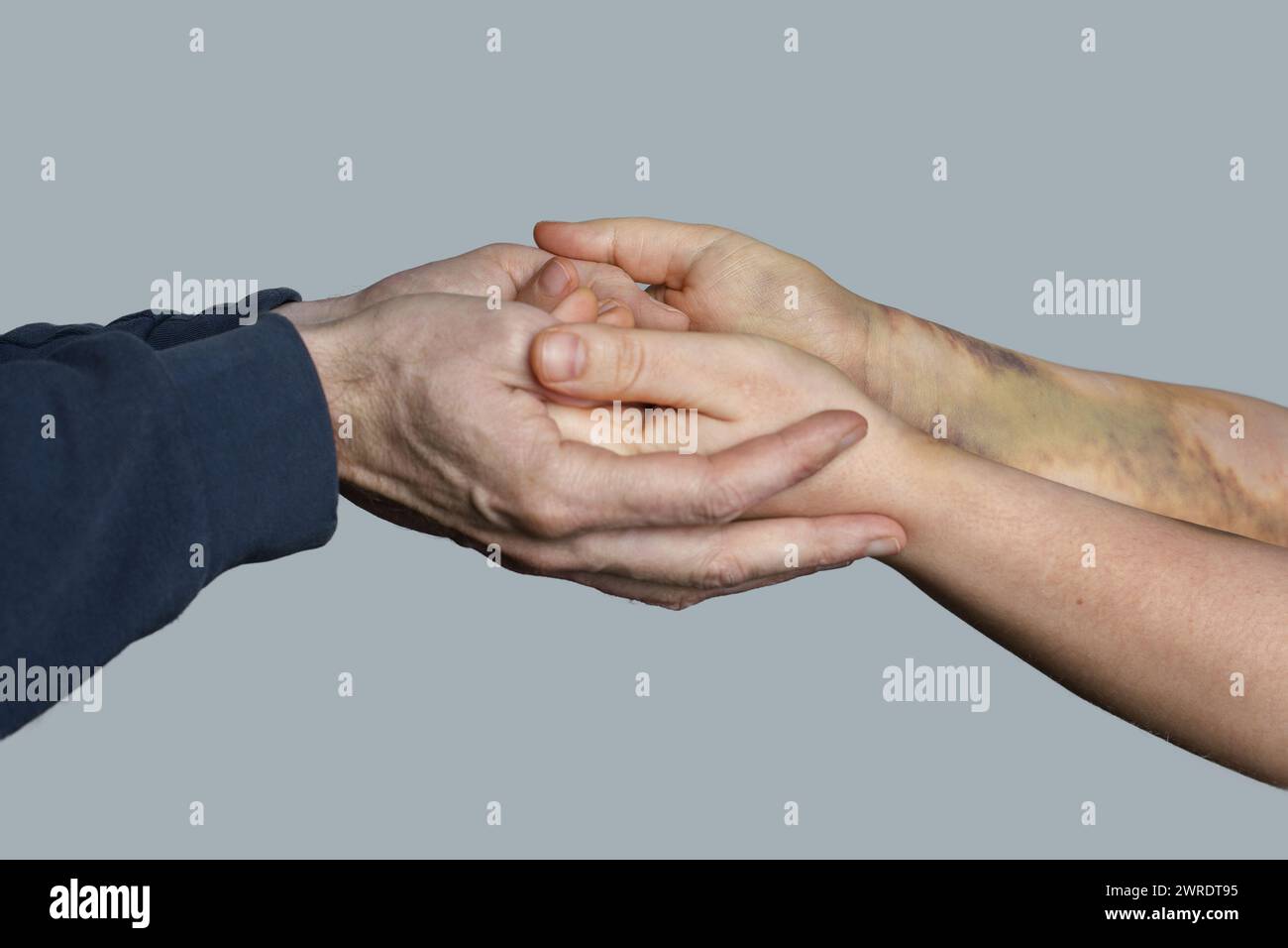 Arrêtez la violence, mettez fin au silence. Soutenir une femme avec des ecchymoses sur les bras Banque D'Images