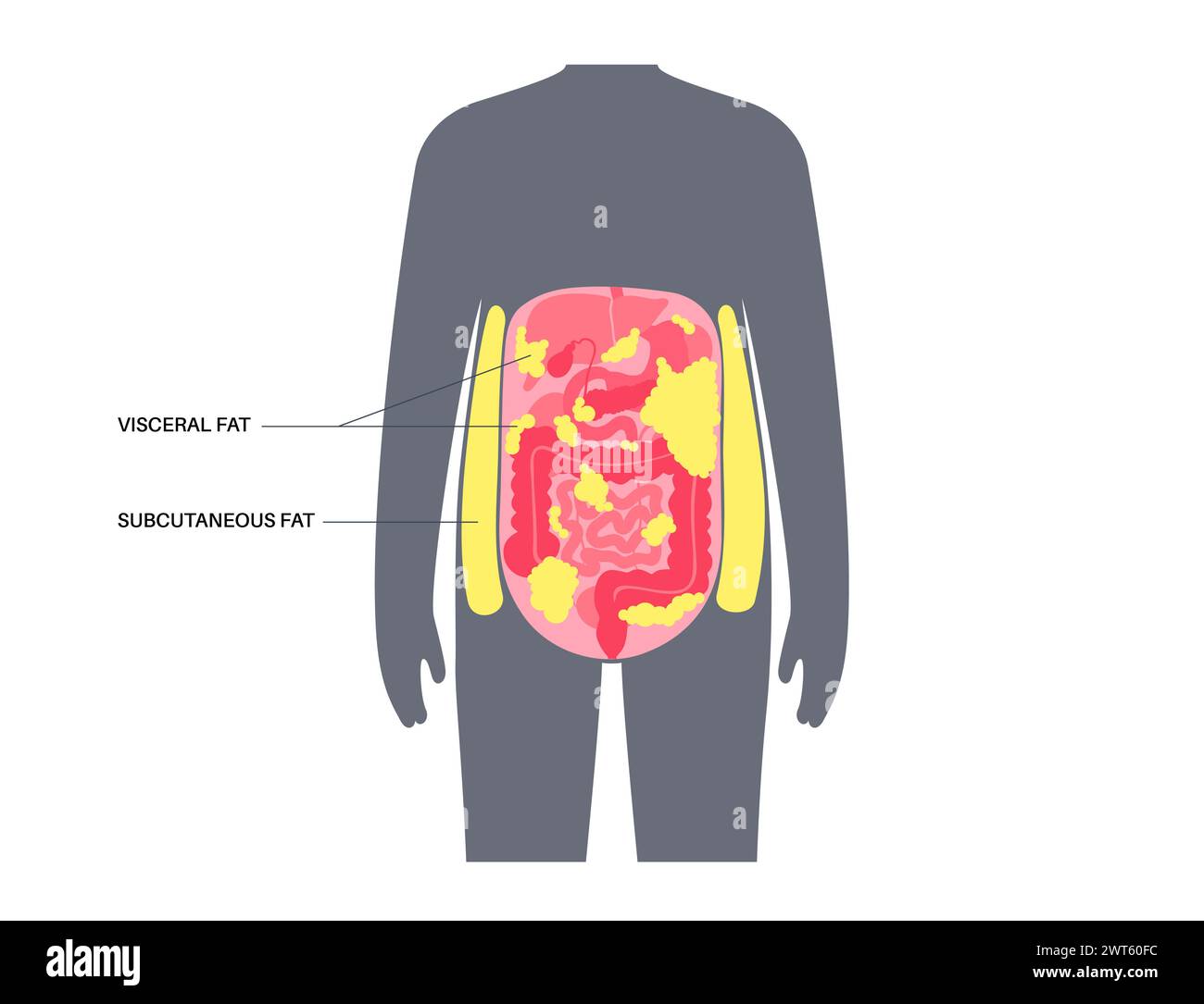 Schéma de la graisse viscérale, illustration. La graisse du ventre entoure les organes internes dans la cavité abdominale. Banque D'Images