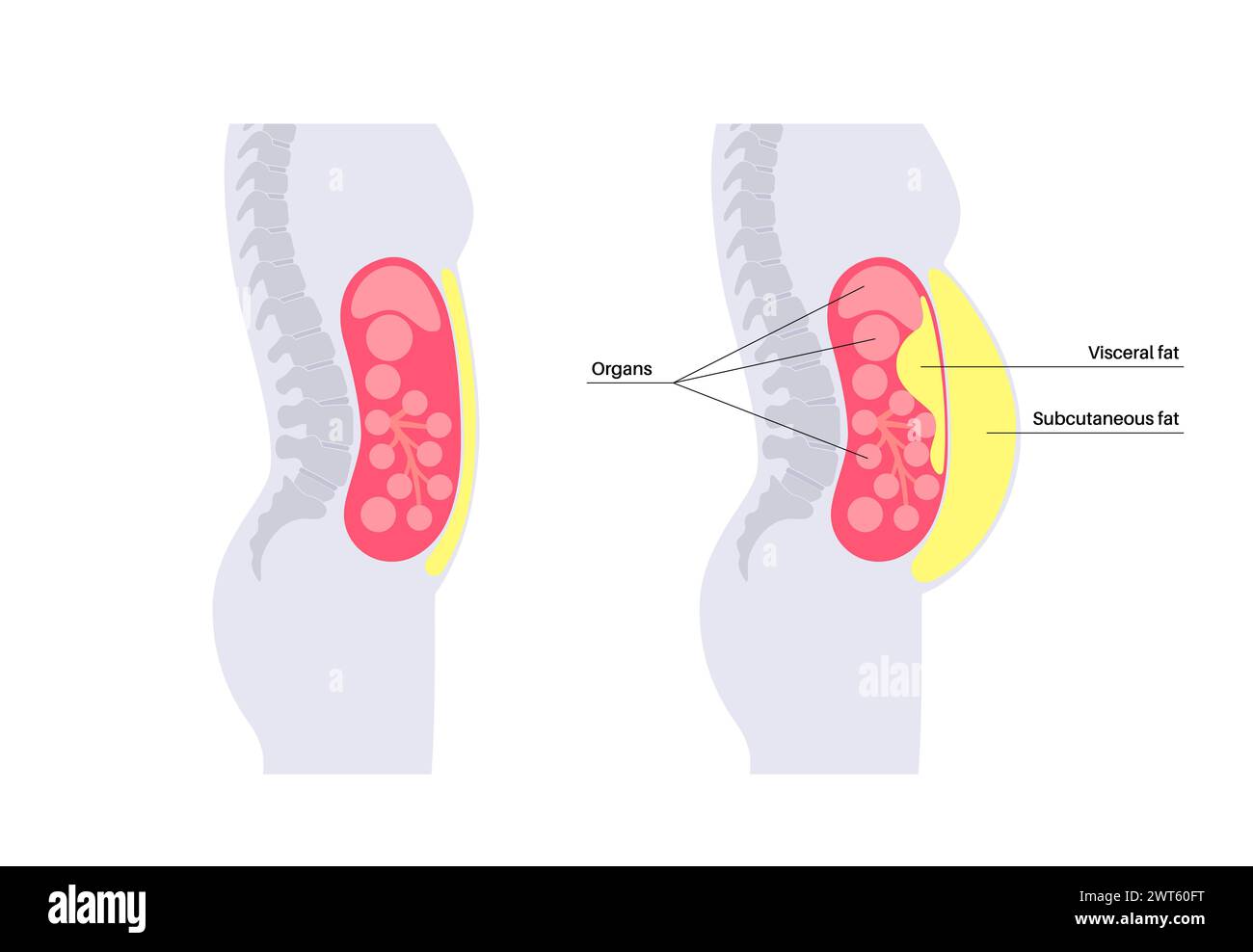 sch-ma-de-la-graisse-visc-rale-illustration-la-graisse-du-ventre