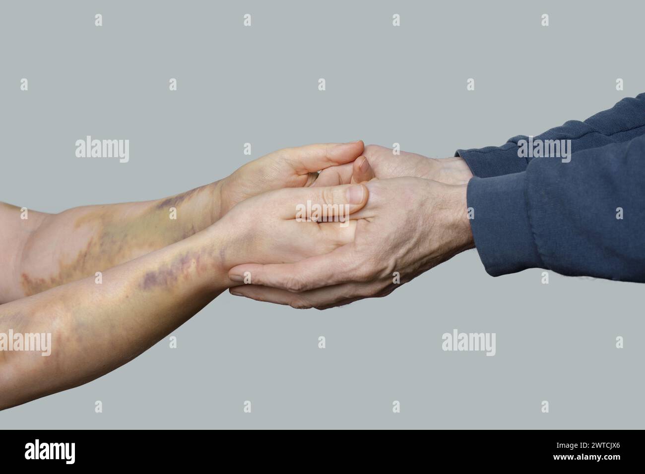 Victime de violence domestique. Stop violence concept Banque D'Images