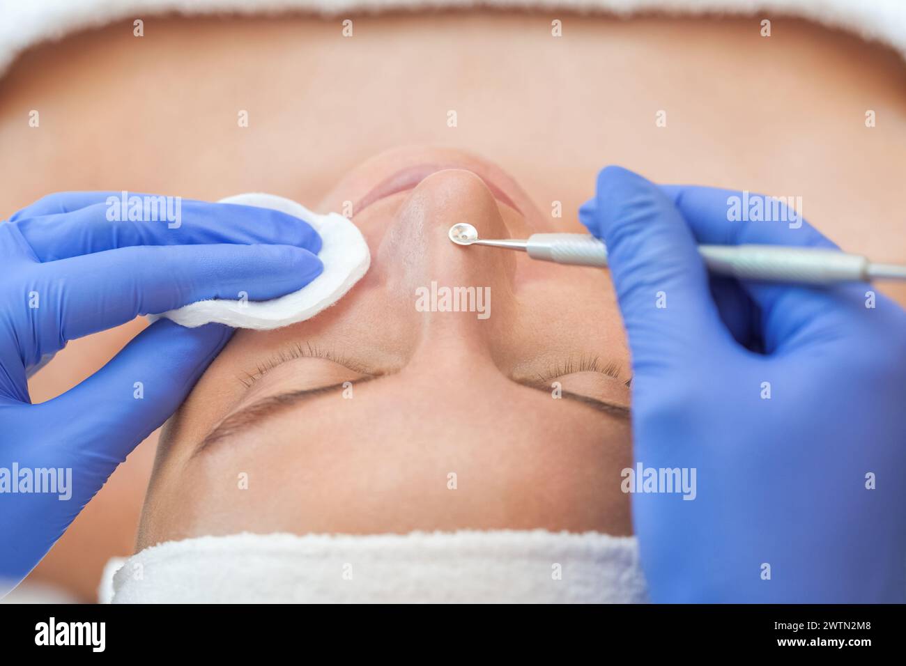Procédure de nettoyage de la peau du visage avec un appareil en acier avec une cuillère de points noirs et l'acné. Banque D'Images