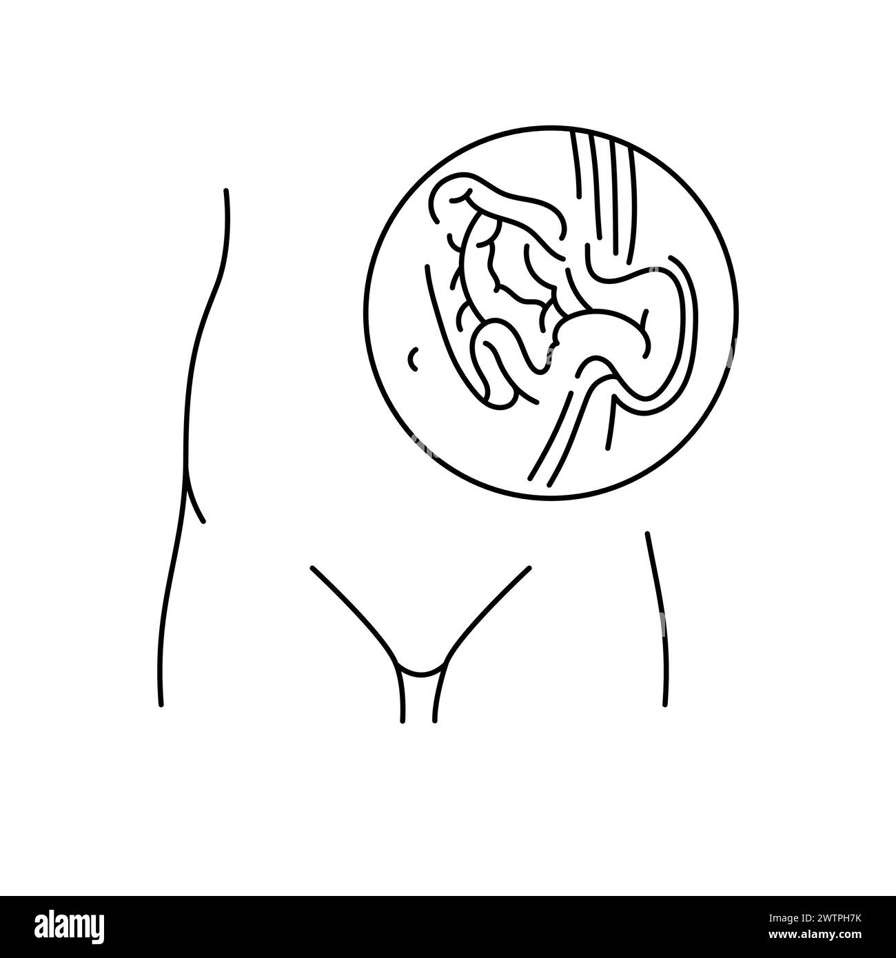 Icône de ligne de hernie ombilicale. Elément isolé par vecteur. Contour modifiable. Illustration de Vecteur