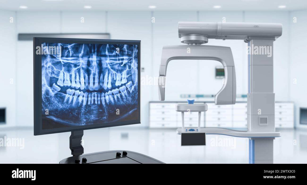 film radiographique numérique de rendu 3d sur moniteur avec scanner dans le cabinet dentaire Banque D'Images