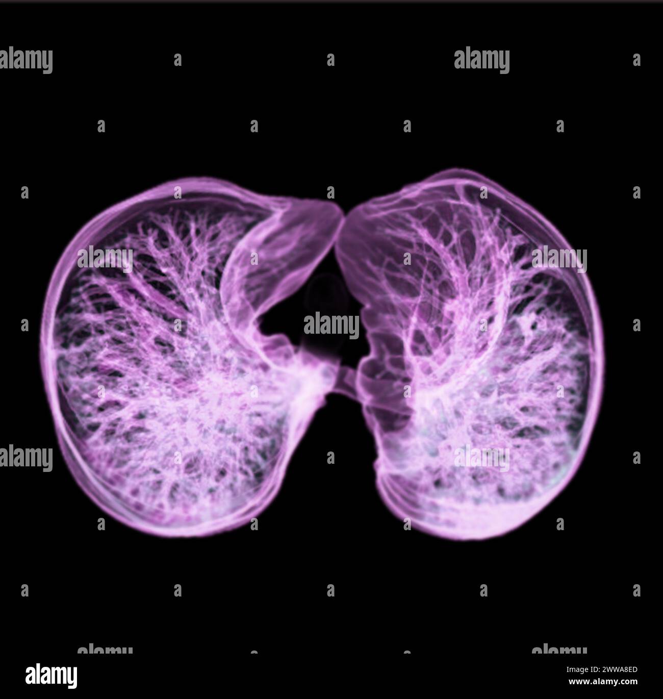 Image CT thorax or Lung 3D montrant la trachée et le poumon dans le système respiratoire. Banque D'Images