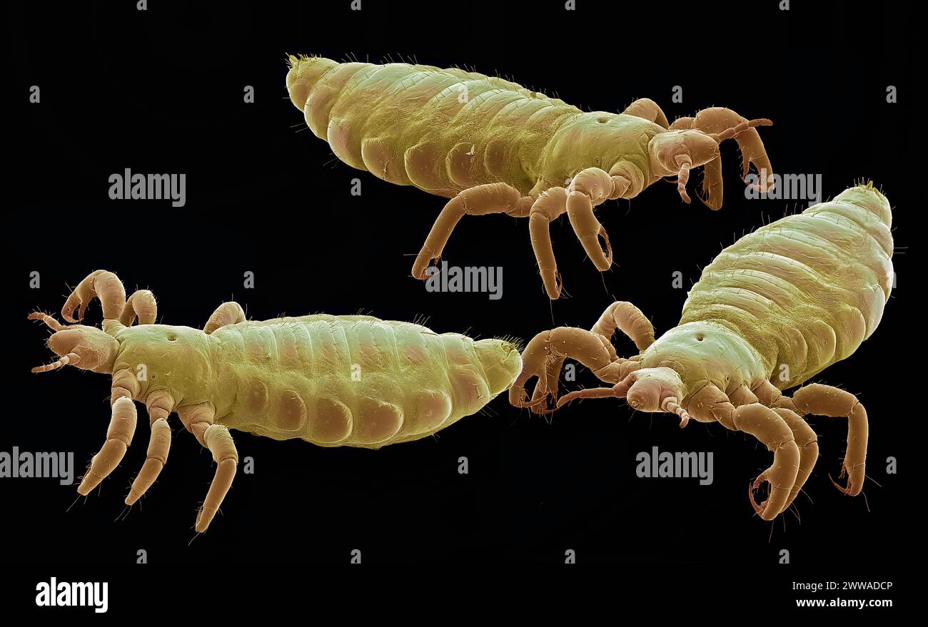 Poux de tête. Micrographie électronique à balayage coloré (MEB) de poux de tête (Pediculus humanus capitis). Grossissement : x10 lors de l'impression de 10 centimètres de large. Banque D'Images