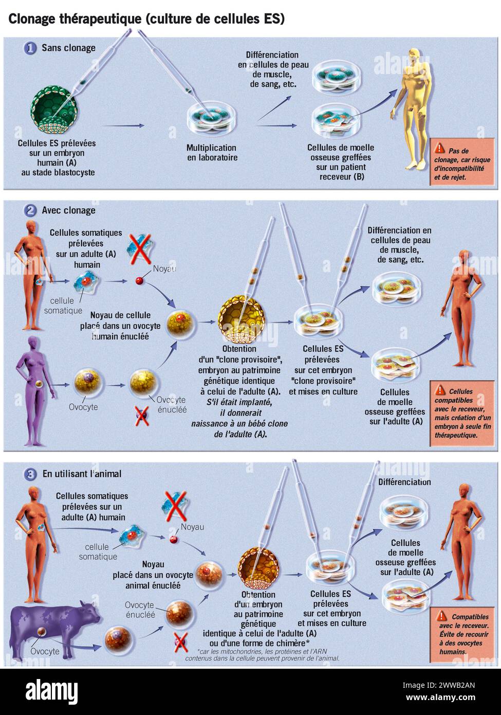 Représentation de différents types de clonage thérapeutique : - prélèvement de cellules d'un blastocyste cultivé en laboratoire donnant des cellules différenciées. Banque D'Images
