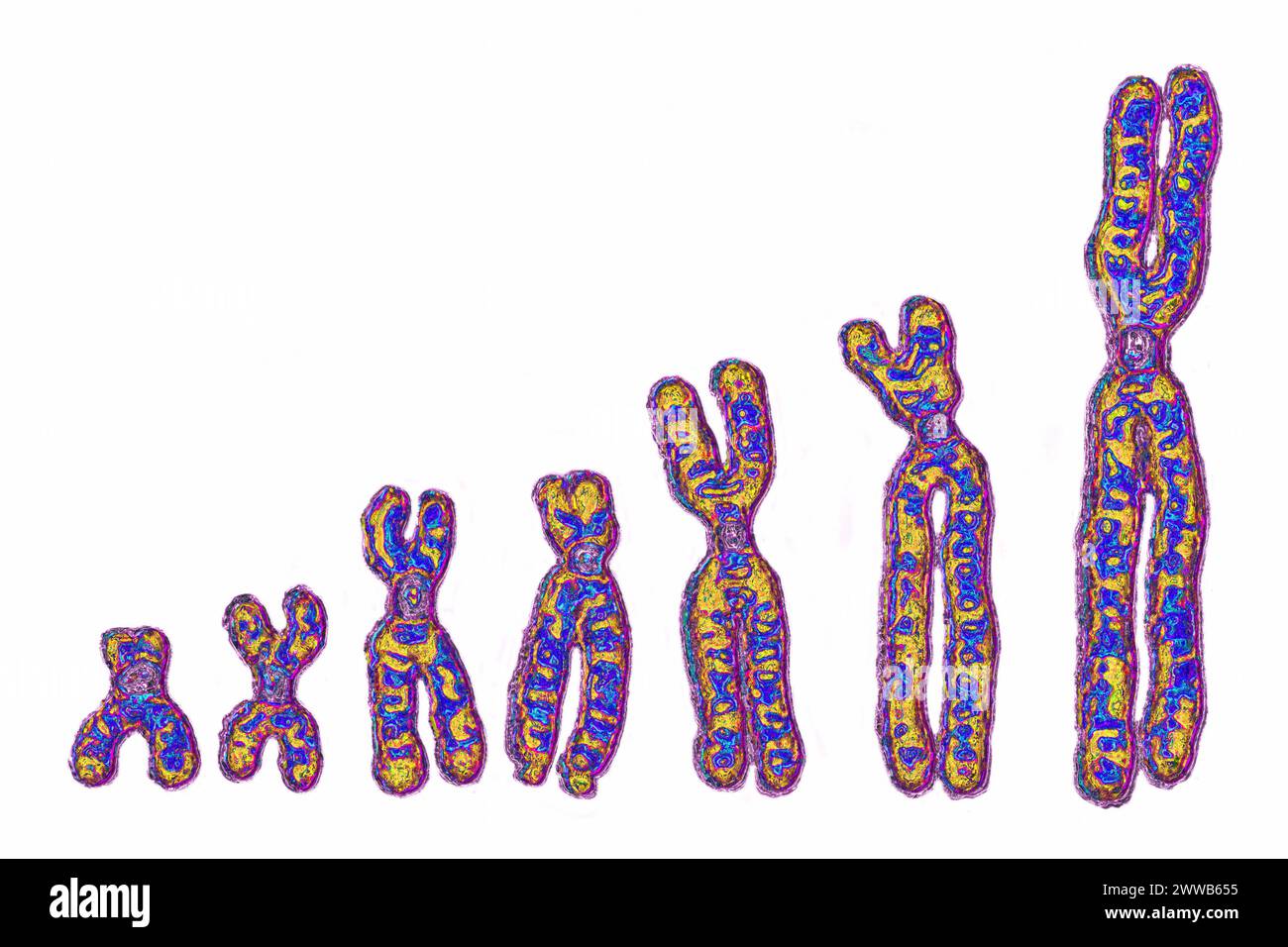 Chromosomes humains (23 paires de chromosomes - 46 chromosomes, 22 paires sont communes aux deux sexes. Banque D'Images