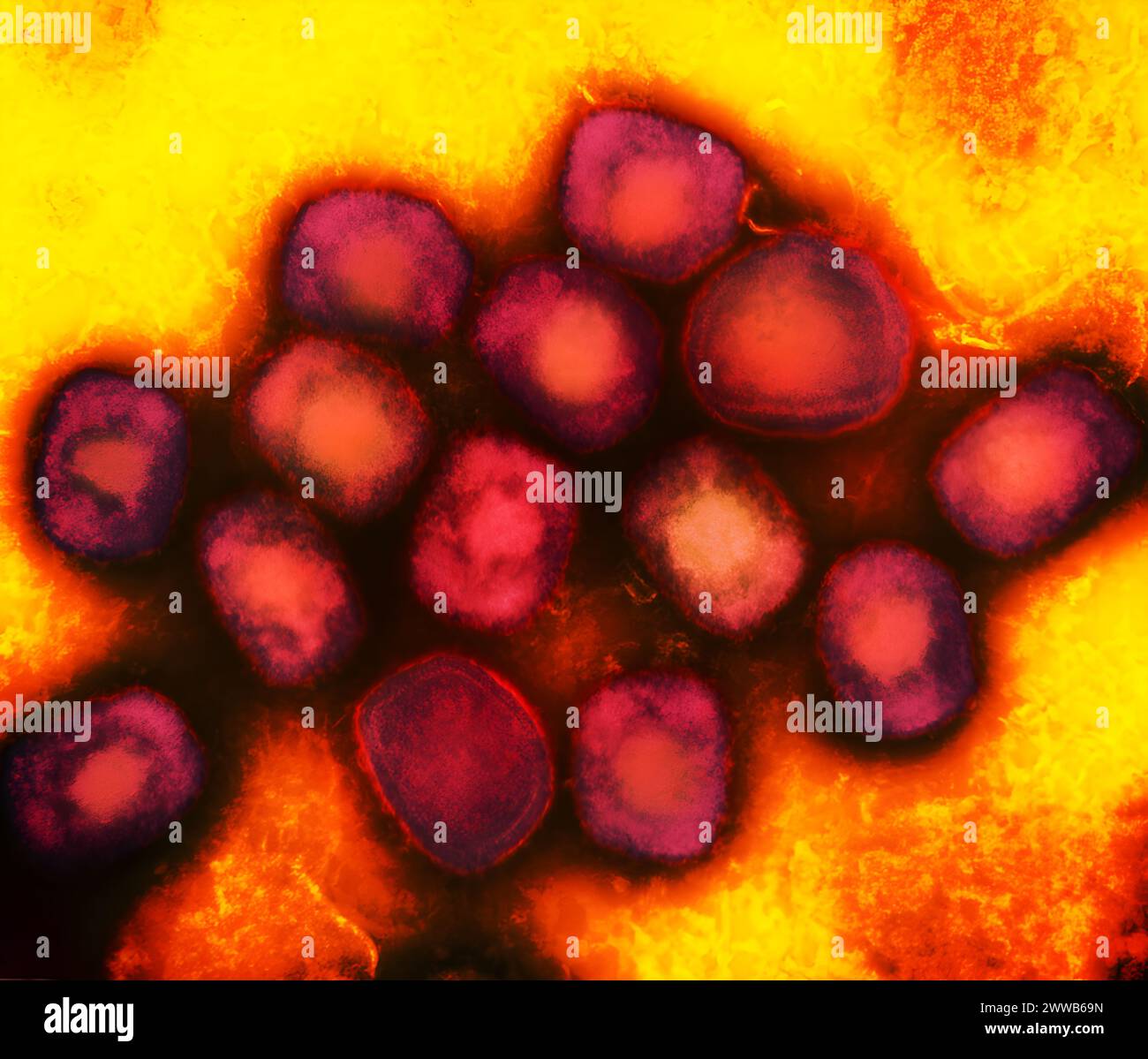 Micrographie électronique à transmission colorisée des particules de virus de la variole du singe (rouge) cultivées et purifiées à partir de cultures cellulaires. Banque D'Images