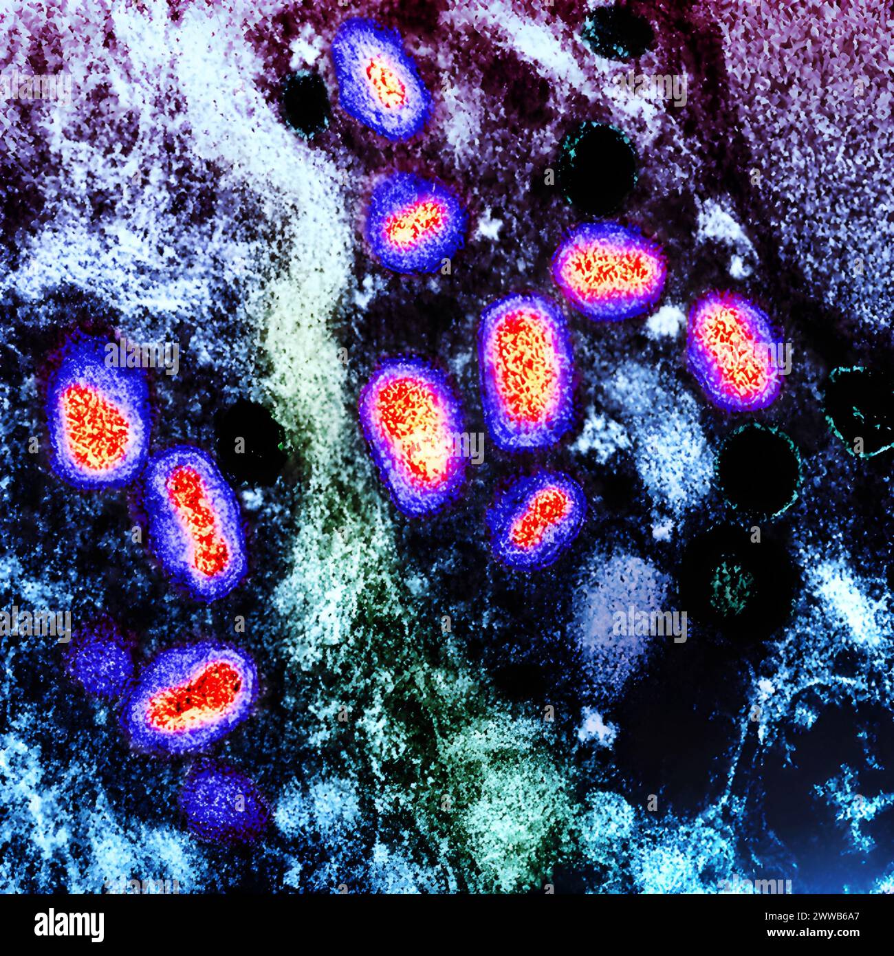 Micrographie électronique par transmission des particules du virus de la variole du singe (rouge/jaune/violet) trouvées dans une cellule infectée (vert et bleu). Banque D'Images