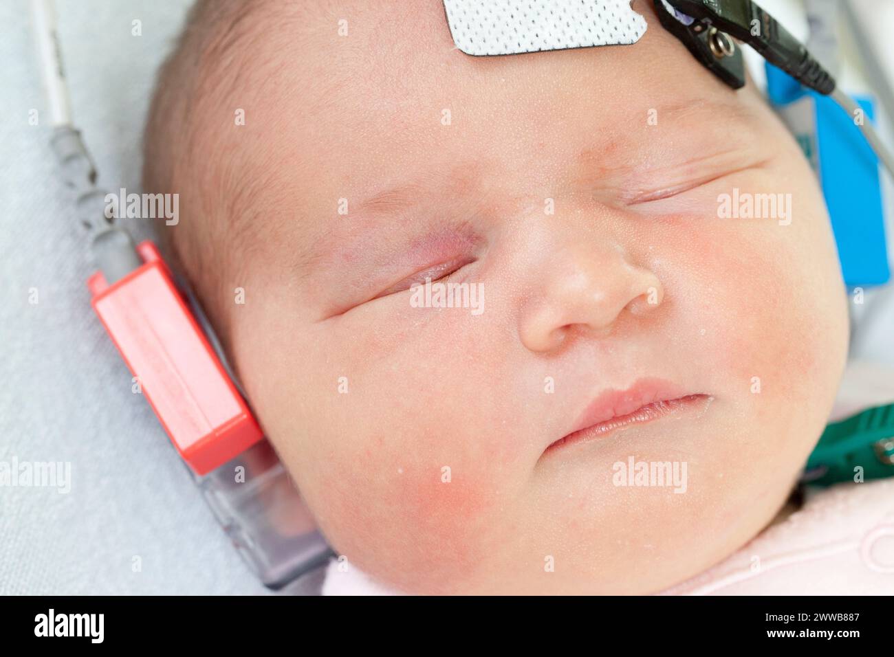 Test auditif - le test PEA (potentiel auditif évoqué) est effectué par un assistant de garde d'enfants sur tous les nouveau-nés à la maternité dans les jours. Banque D'Images