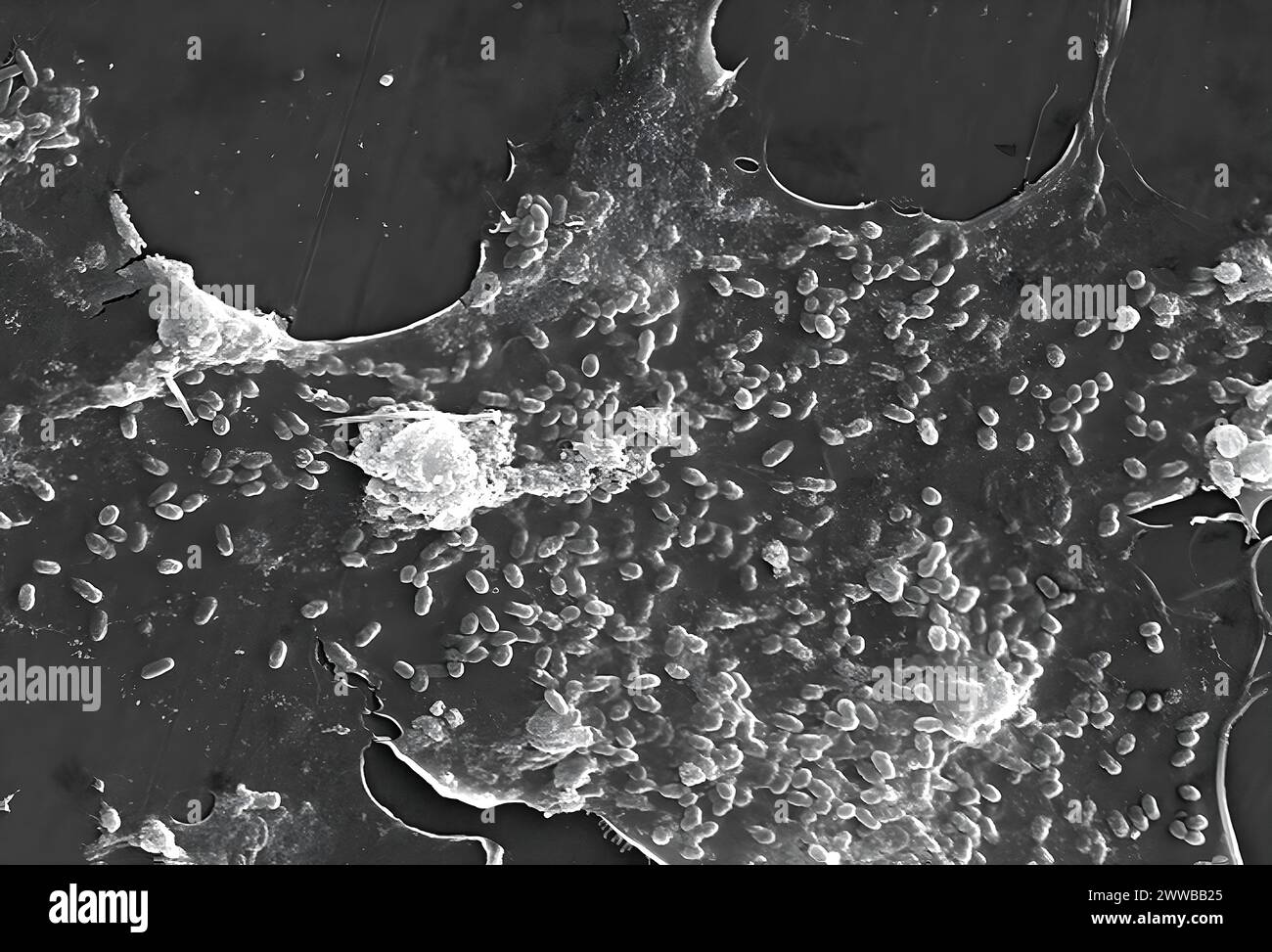 Cette image au microscope électronique à balayage (MEB) d'un spécimen d'eau non traitée extrait d'un ruisseau sauvage principalement utilisé pour contrôler les inondations. Banque D'Images