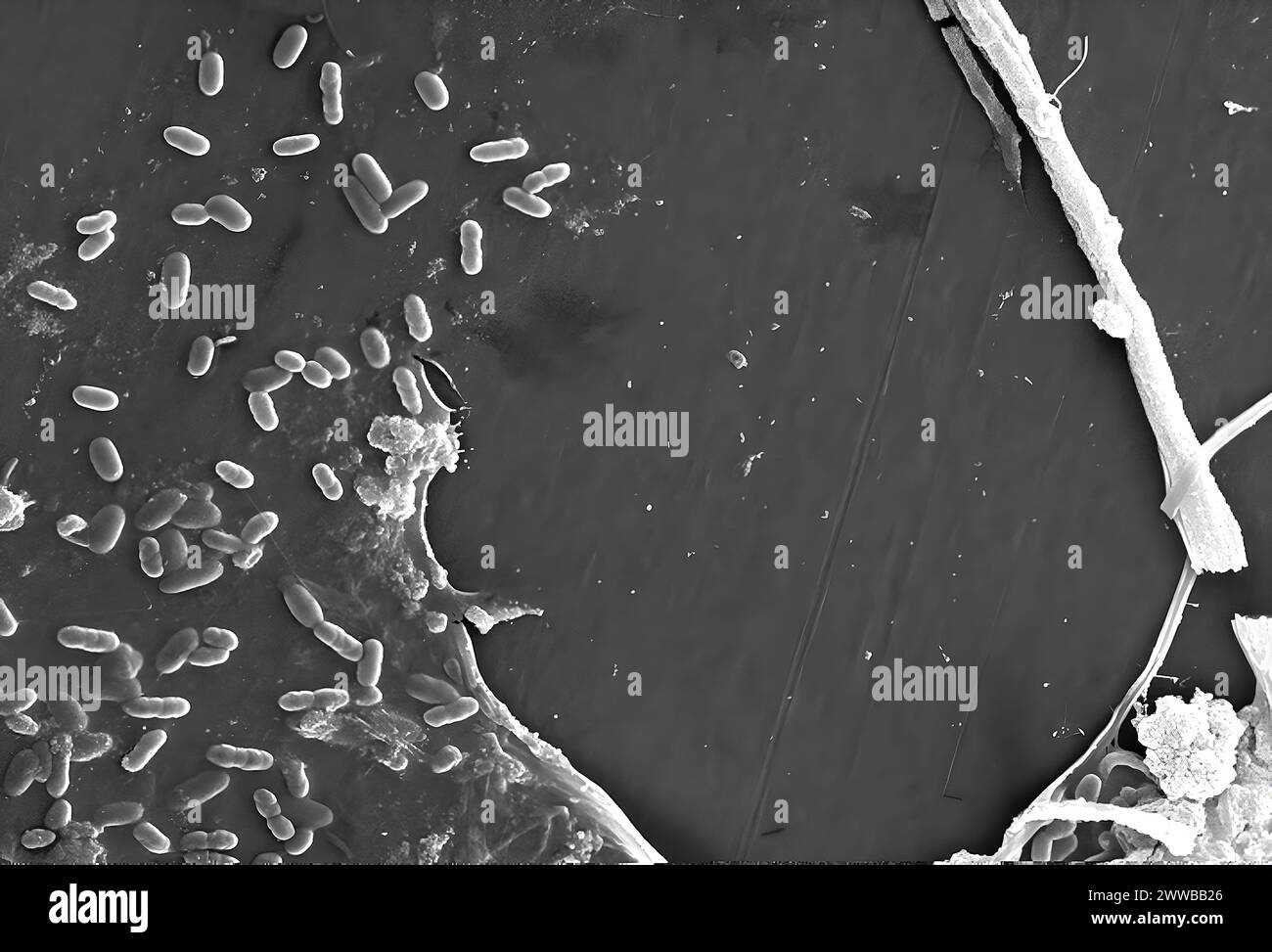 Cette image au microscope électronique à balayage (MEB) d'un spécimen d'eau non traitée extrait d'un ruisseau sauvage principalement utilisé pour contrôler les inondations. Banque D'Images