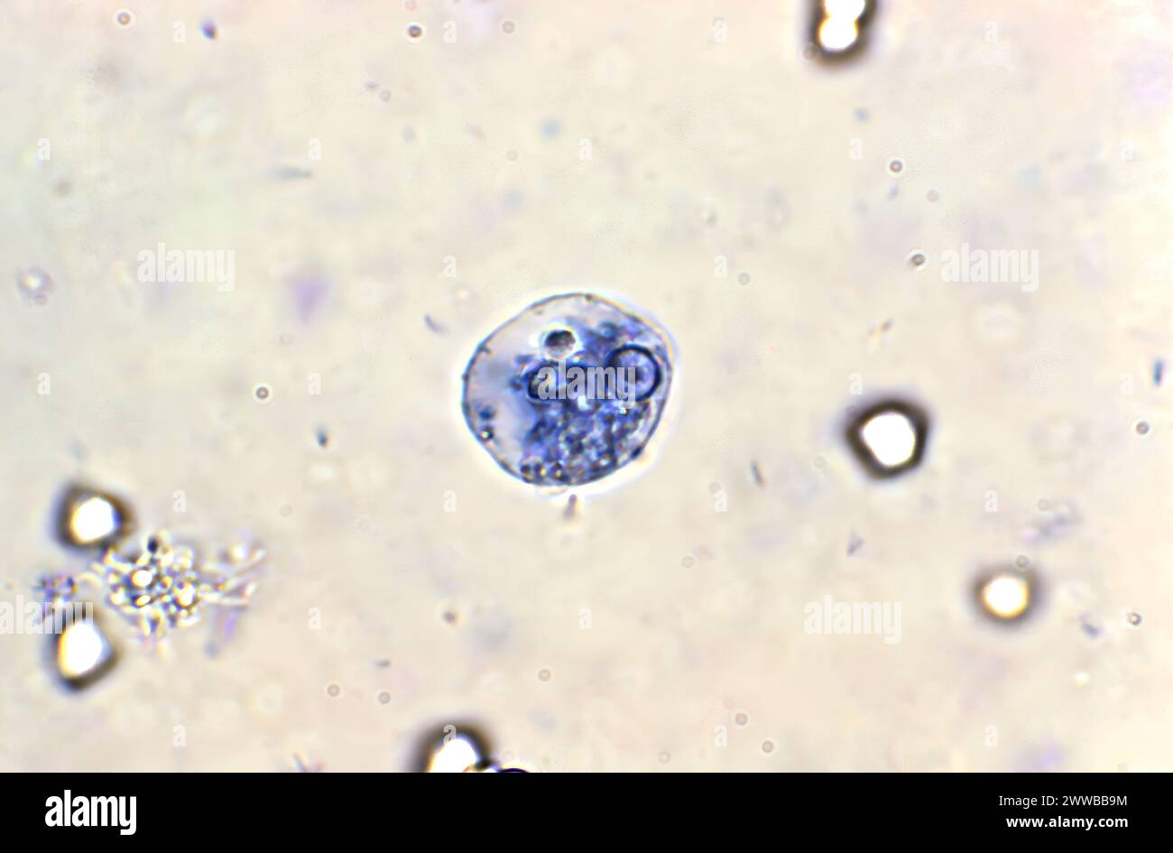 En utilisant une technique de coloration au bleu de méthylène, cette photomicrographie a révélé la présence d'un seul trophozoïte d'Entamoeba moshkovskii. Banque D'Images