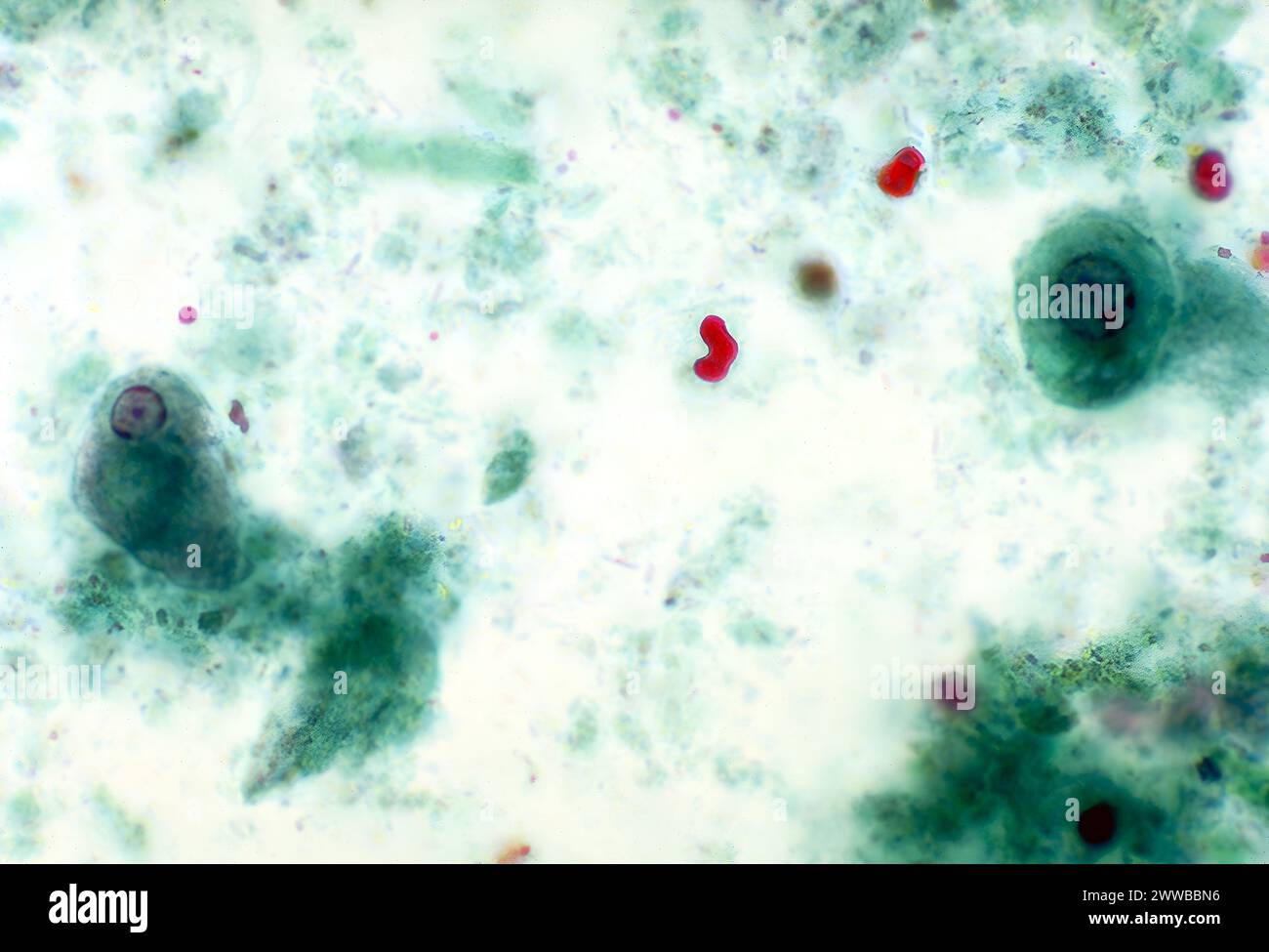 Cette photomicrographie colorée au trichrome représente deux amibes parasites d'Entamoeba histolytica, parmi des débris cellulaires. CDC/Dr Mae Melvin 1977. Banque D'Images