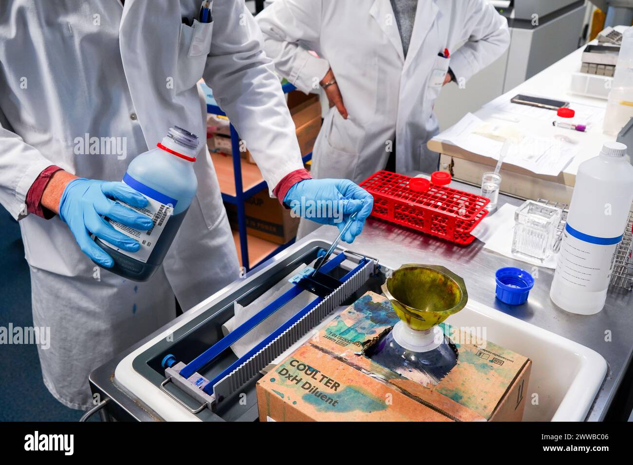 Plateforme technique du laboratoire Inovie 34 . Coloration d'une lame palustre et frottis diagnostique pour écarter le paludisme chez un patient. Banque D'Images