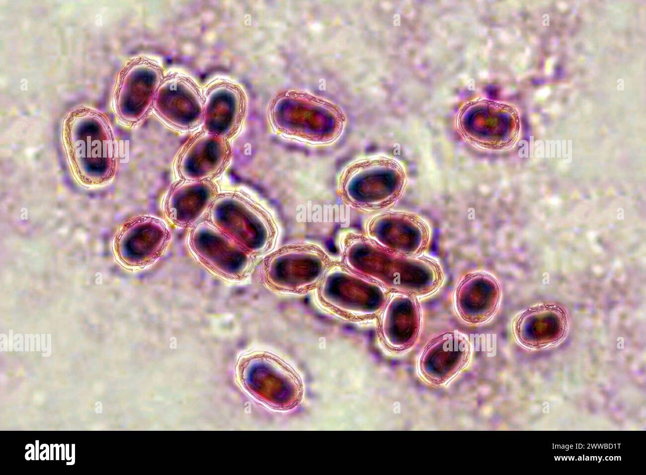 Pneumocoque (Streptococcus pneumoniae), le pneumocoque est une bactérie impliquée dans la pneumonie, la bronchopneumonie, la pleurésie purulente, la méningite bactérienne. Banque D'Images