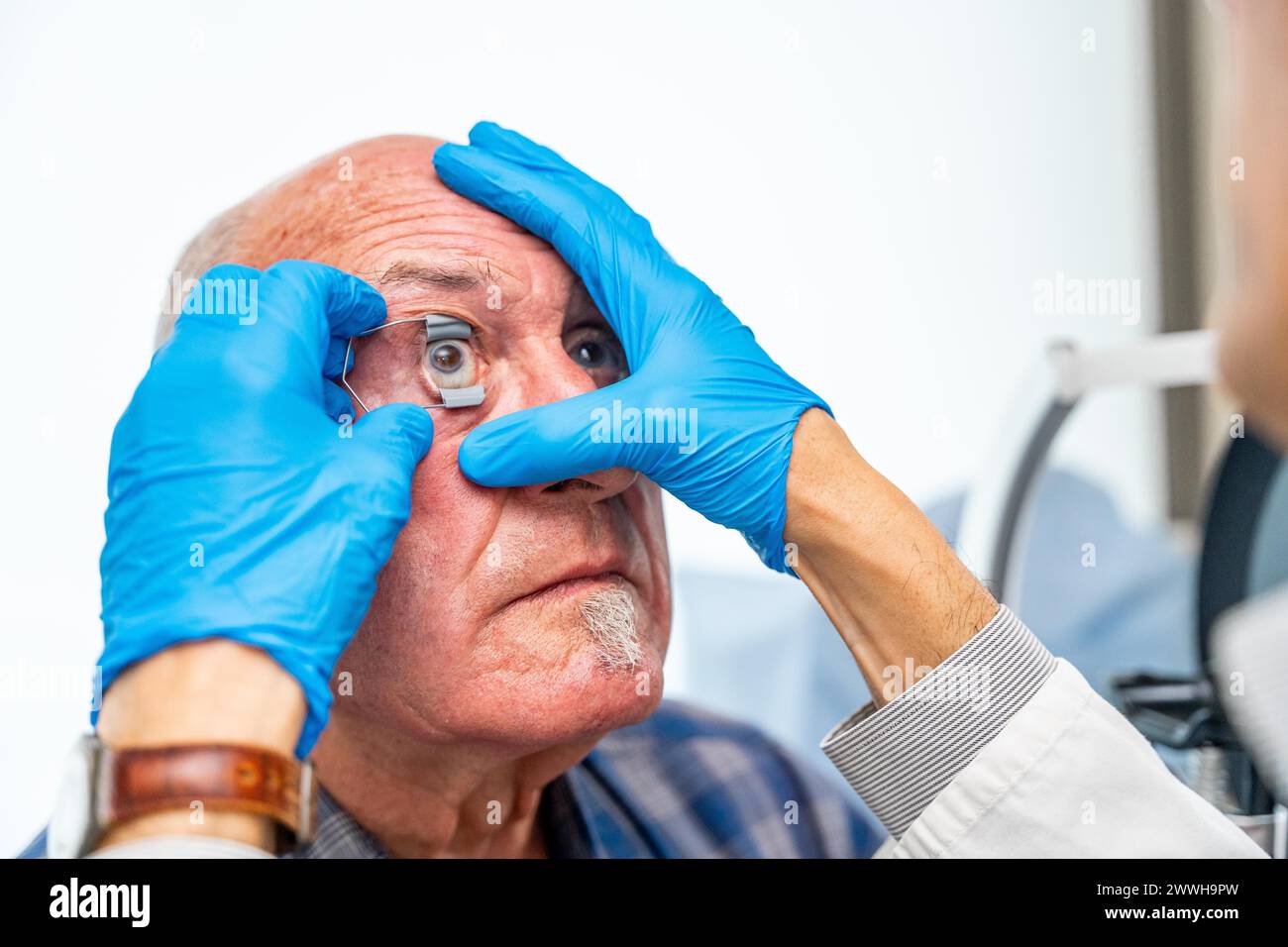 Ophtalmologiste appliquant un ouvre-oeil sur un patient âgé avant un traitement innovant du glaucome Banque D'Images