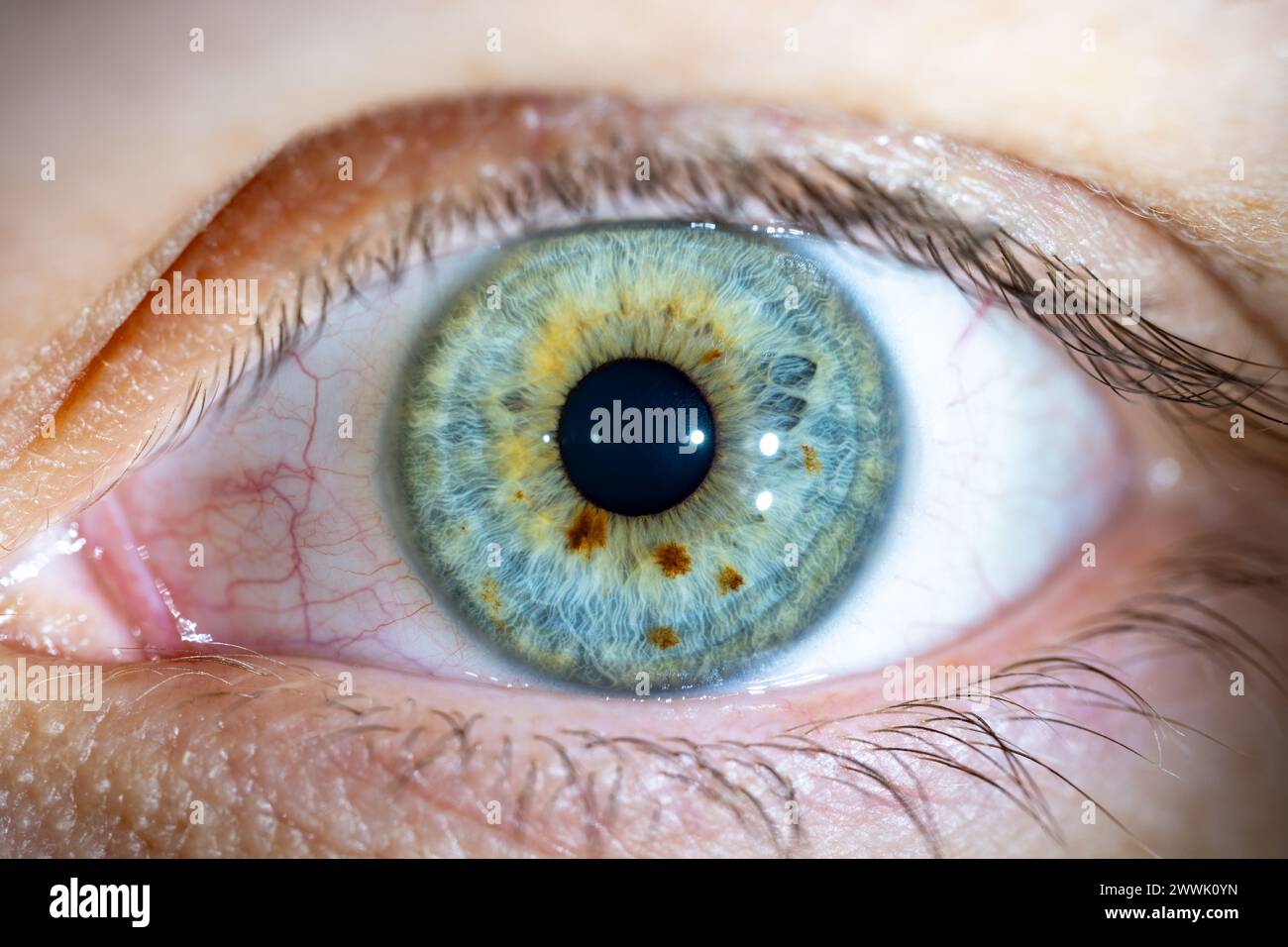 Description : oeil de couleur bleu-vert féminin avec des taches pigmentaires brunes. Pupille ouverte. Gros plan. Anatomie structurelle. Détail de la macro de l'iris humain. Banque D'Images