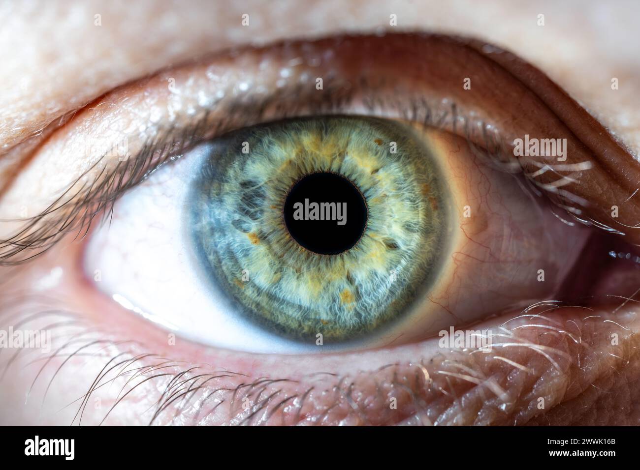 Description : oeil de couleur bleu-vert féminin avec des taches pigmentaires brunes. Pupille ouverte. Gros plan. Anatomie structurelle. Détail de la macro de l'iris humain. Banque D'Images