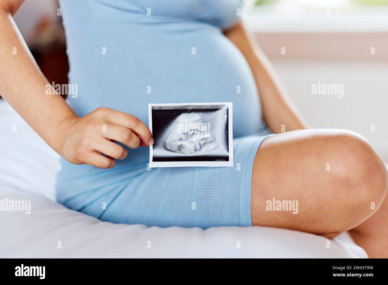 Femme enceinte avec la photo de bébé scan Banque D'Images