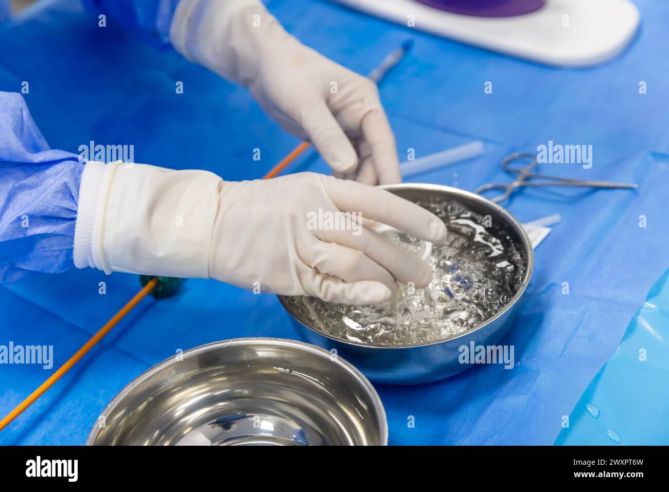 Cardiologie de la chirurgie valvulaire cardiaque en milieu hospitalier. Préparer l'implantation de la valve aortique transcathéter dans la main du médecin. Banque D'Images