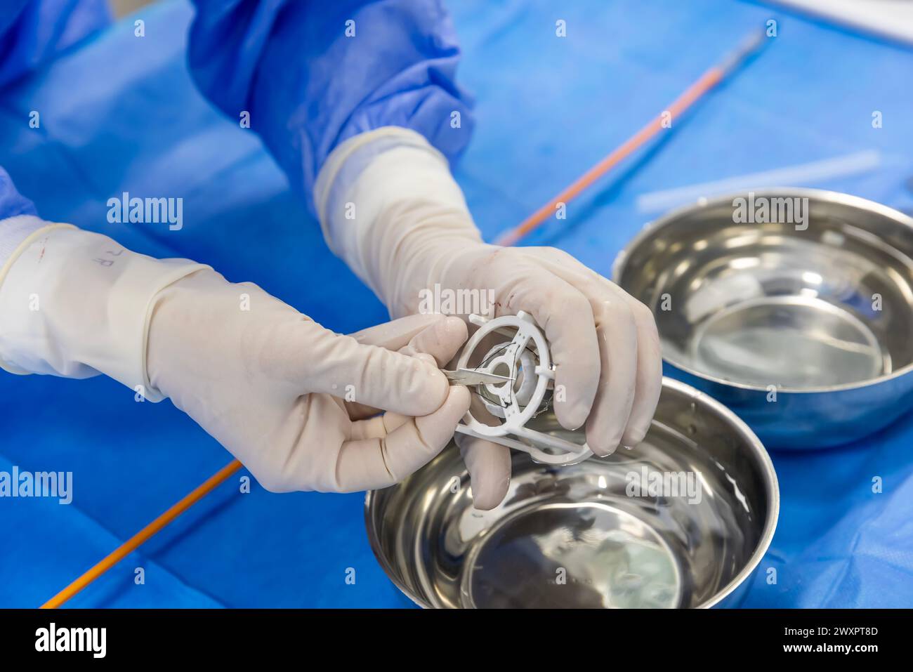 Cardiologie de la chirurgie valvulaire cardiaque en milieu hospitalier. Préparer l'implantation de la valve aortique transcathéter dans la main du médecin. Banque D'Images