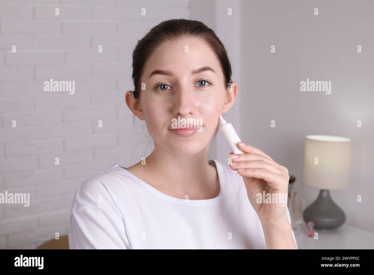 Femme avec problème d'acné appliquant la crème à la maison Banque D'Images