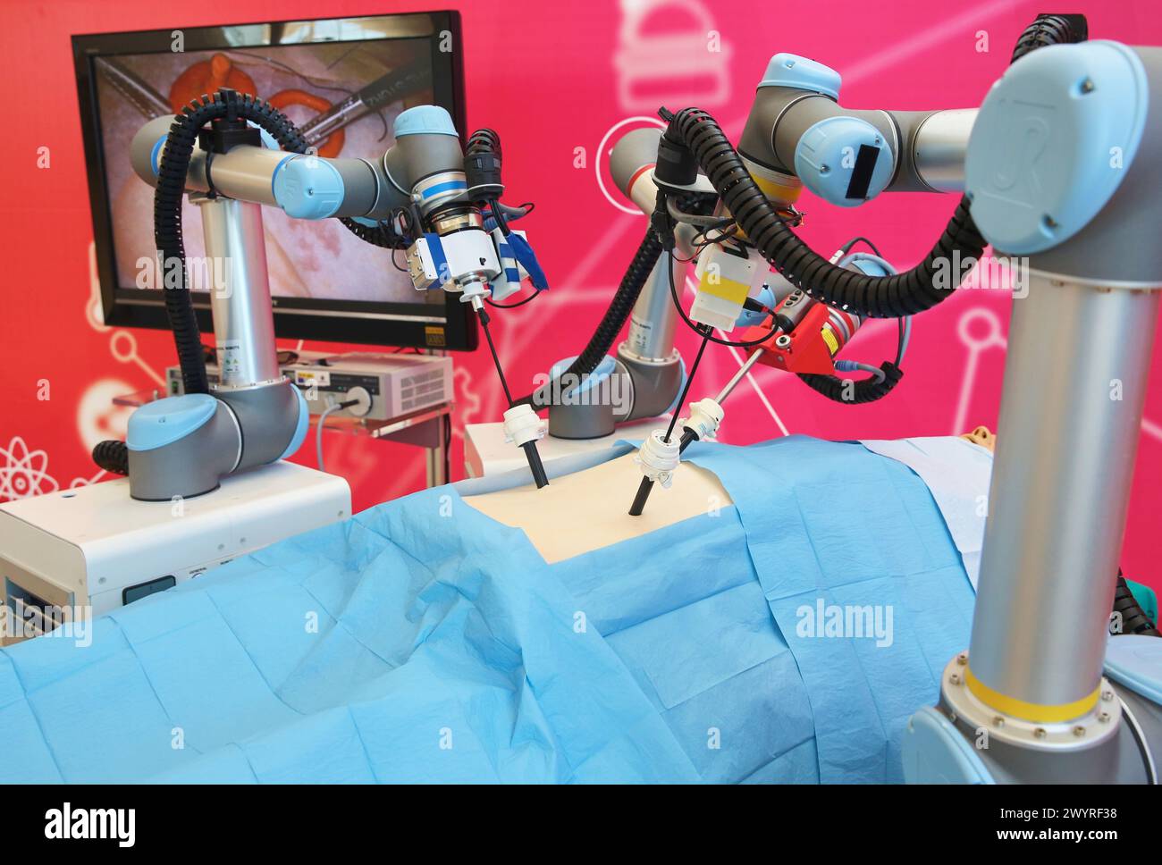 Développement d'un robot chirurgical avec vision 3D et sensations tactiles. Ce projet s’est appuyé sur les conseils des chirurgiens pour la conception et la fabrication du dispositif. Le but de cette collaboration entre ingénieurs et médecins était d'apporter des bénéfices et une valeur ajoutée dans le domaine de la chirurgie laparoscopique. Le robot comprend trois bras qui peuvent fonctionner à la fois de manière coordonnée individuellement et par conséquent le chirurgien peut s'adapter en fonction des besoins de chaque opération. Propulsé par Tecnalia Research & innovation, Université de Córdoba et l'Institut de recherche biomédicale Maimonide de Cordoue (Im Banque D'Images