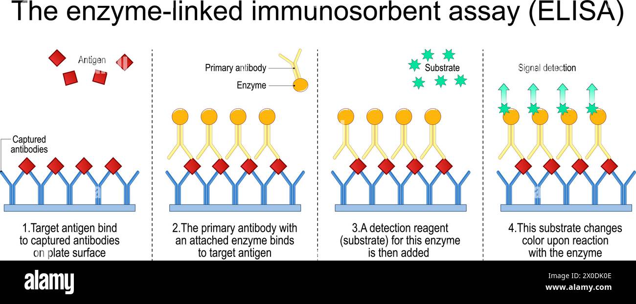 Dosage immunoenzymatique. Les étapes d'Un test ELISA sandwich pour détecter l'antigène. Dosage immunologique. Détection d'anticorps. illustration vectorielle isoler Illustration de Vecteur