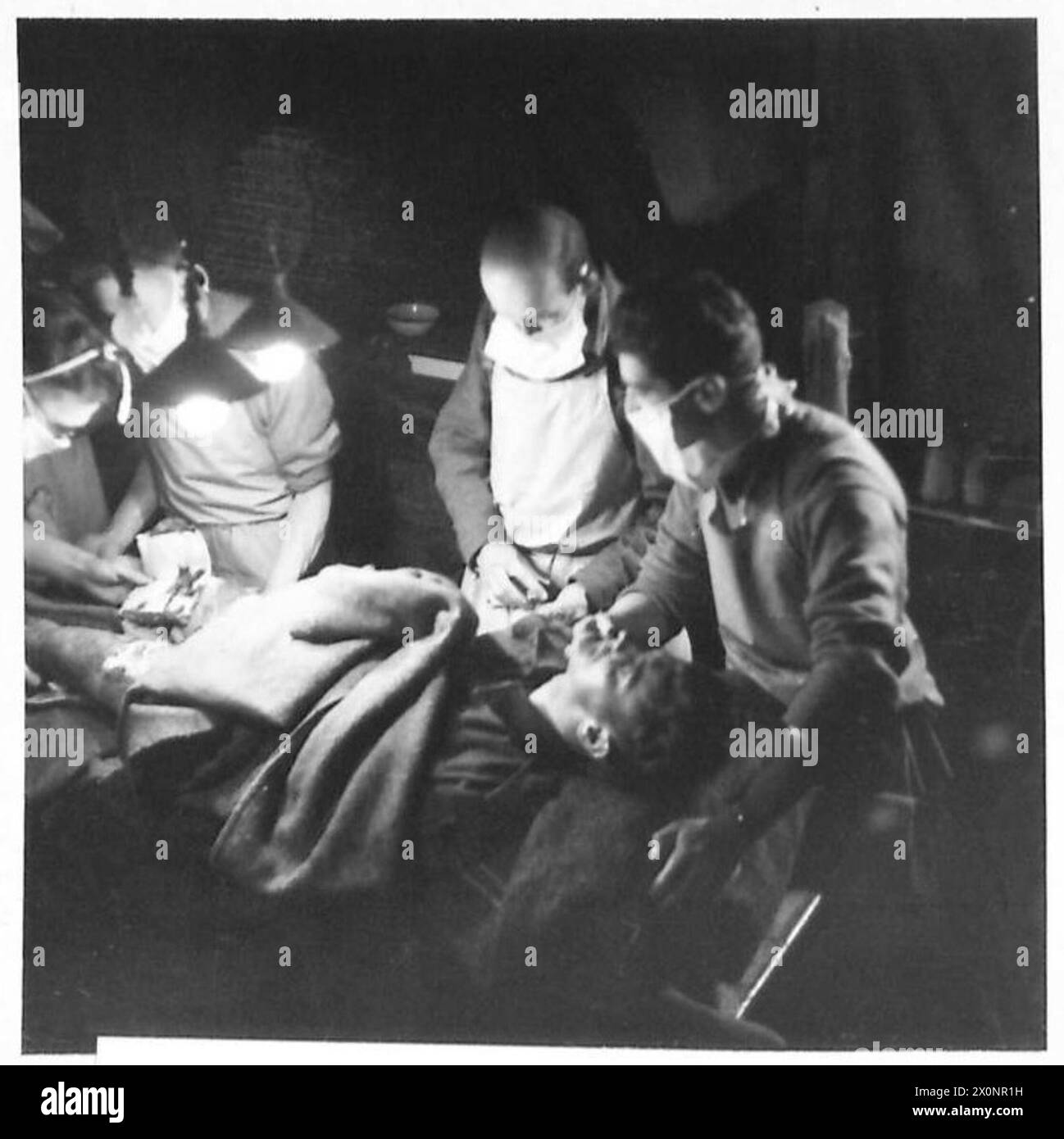 ITALIE : CINQUIÈME ARMYNURSES DANS LA TÊTE DE PONT ANZIO - dans la salle d'opération de l'unité de chirurgie de terrain 36. L'anesthésie est administrée par le Capt. E.R. Kennedy, tandis que l/CPL. PAR EXEMPLE interrogé, RAMC est à la tête du patient. Négatif photographique, Armée britannique Banque D'Images