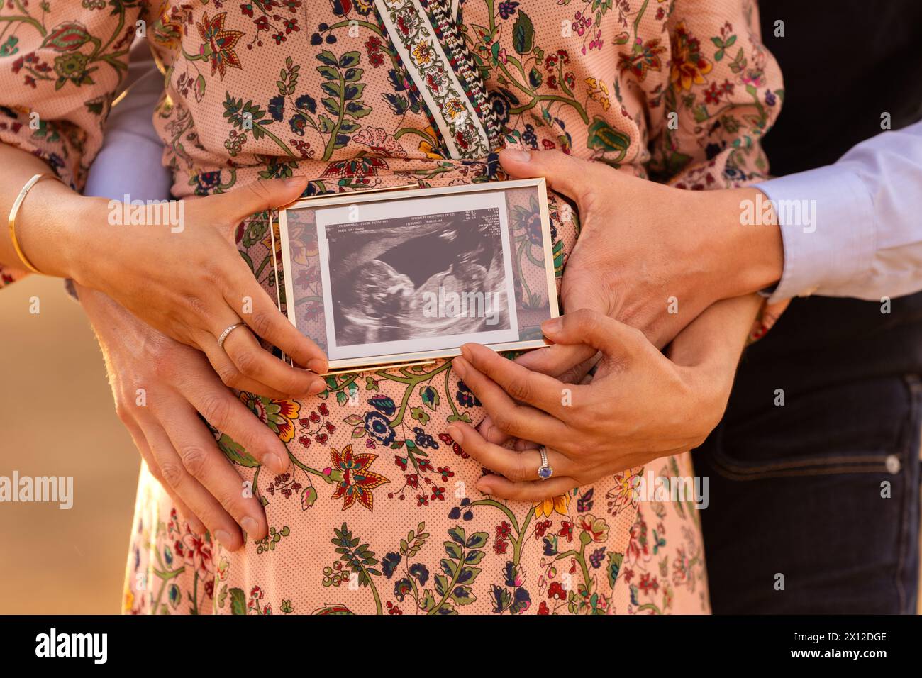 Gros plan d'une photo d'échographie devant le ventre d'une femme enceinte Banque D'Images
