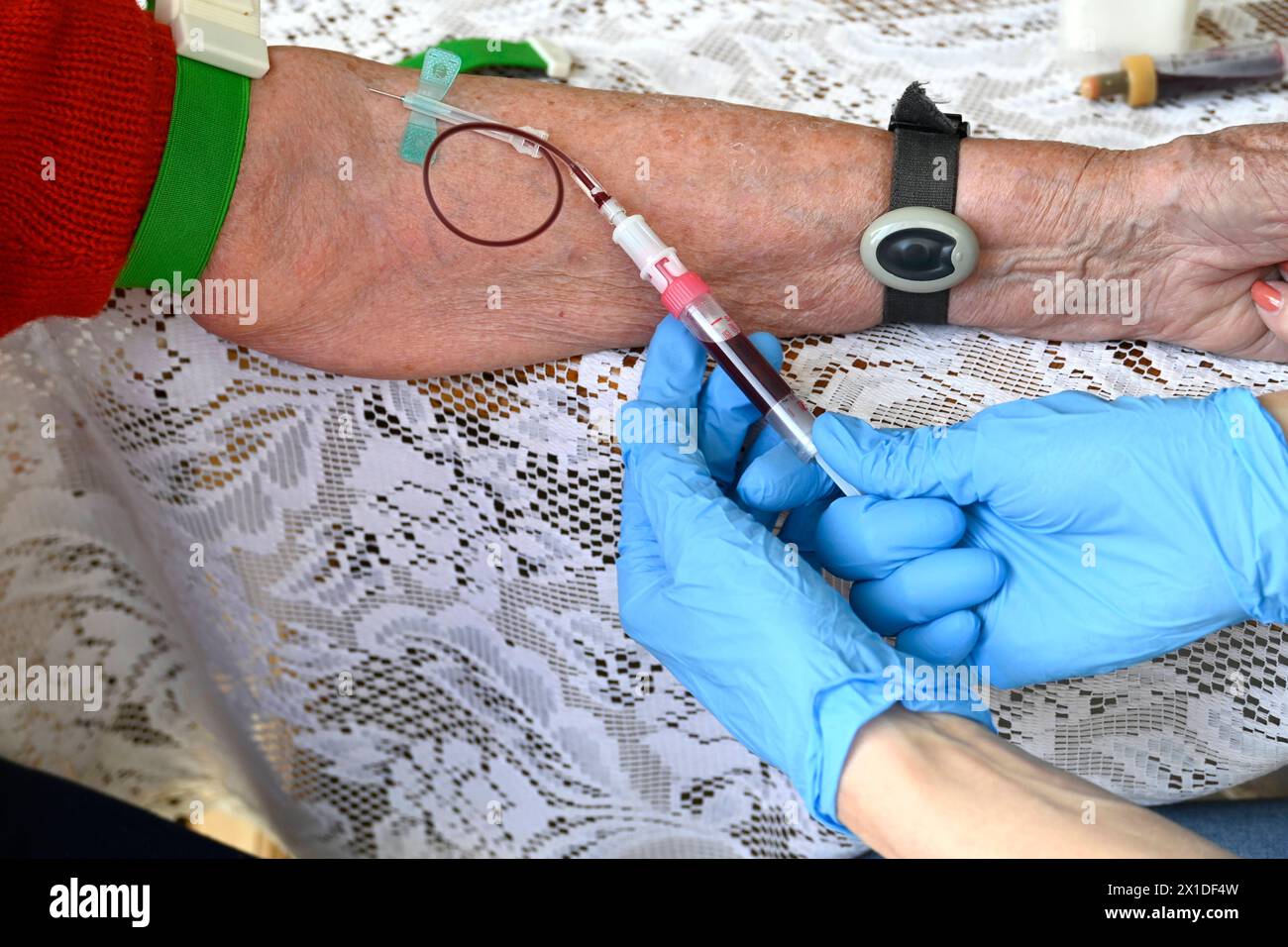 München, 20.03.24, Ärztin nimmt alter Patientin Blut ab, Blutabnahme, Nadel, Flügelkanüle Butterfly - Kanüle oder Schmetterling genannt besondere Form der Kanüle. Blutentnahme, intravenöse Applikation von Medikamenten oder Flüssigkeitstherapie, Vacusera Blutentnahmenadeln, Venen, Vene, *** Munich, 20 03 24, le médecin prend le sang du vieux patient, prélèvement sanguin, aiguille, canule papillon ou papillon appelé forme spéciale de prélèvement sanguin canule, application intraveineuse de médicaments ou de thérapie fluidique, aiguilles de prélèvement sanguin Vacusera, veines, veine, Banque D'Images