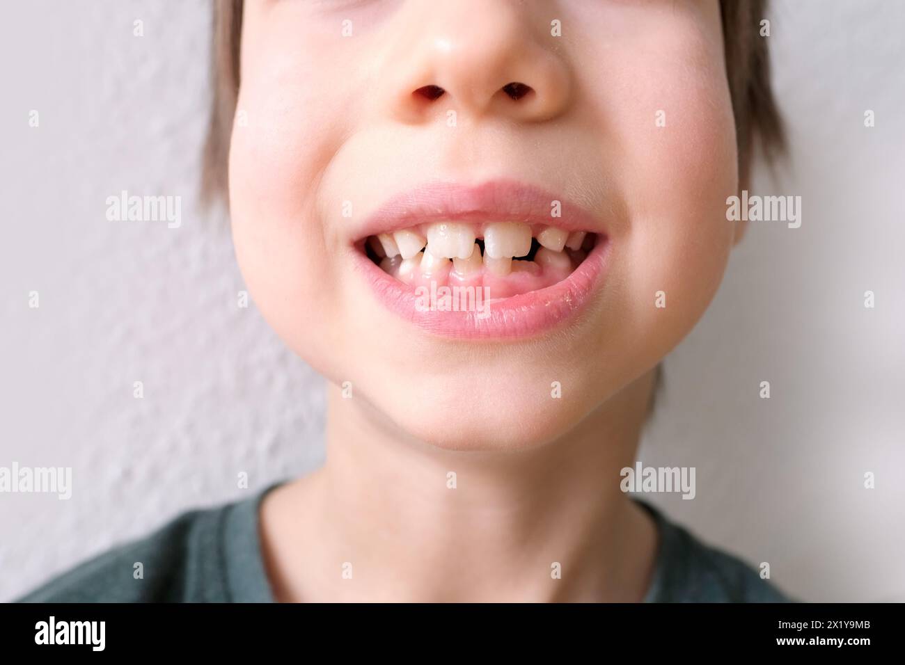 petit enfant, enfant de 7-8 ans assis avec la bouche ouverte, les dents en gros plan, examen de la molaire par un dentiste, concept de traitement dentaire, vérification de la morsure Banque D'Images