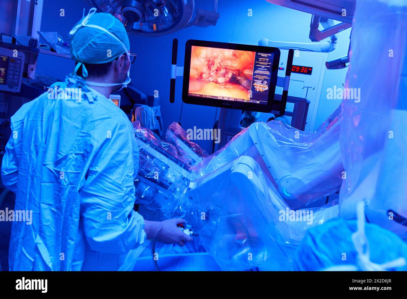 Traitement chirurgical du cancer de la prostate, prostatectomie radicale, robot chirurgical Da Vinci, équipe de chirurgiens des docteurs Madina & Azparren, Urologie, chirurgie Banque D'Images