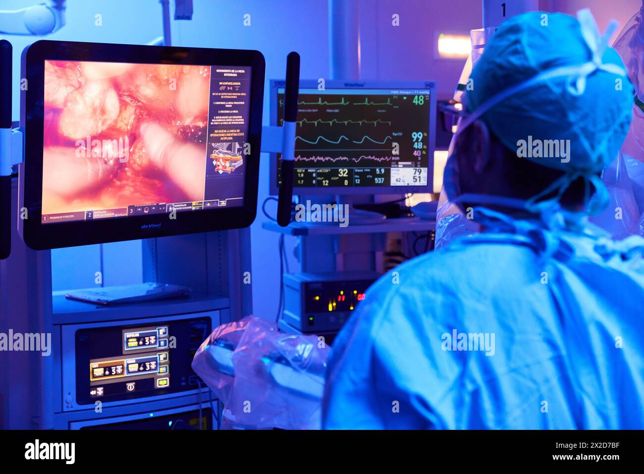 Traitement chirurgical du cancer de la prostate, prostatectomie radicale, robot chirurgical Da Vinci, équipe de chirurgiens des docteurs Madina & Azparren, Urologie, chirurgie Banque D'Images