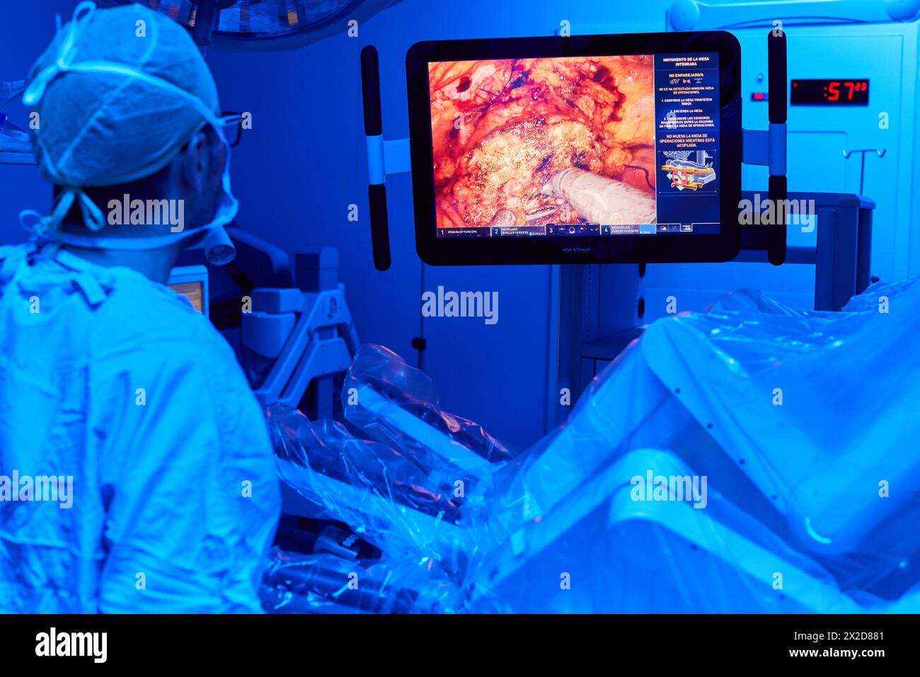 Traitement chirurgical du cancer de la prostate, prostatectomie radicale, robot chirurgical Da Vinci, équipe de chirurgiens des docteurs Madina & Azparren, Urologie, chirurgie Banque D'Images