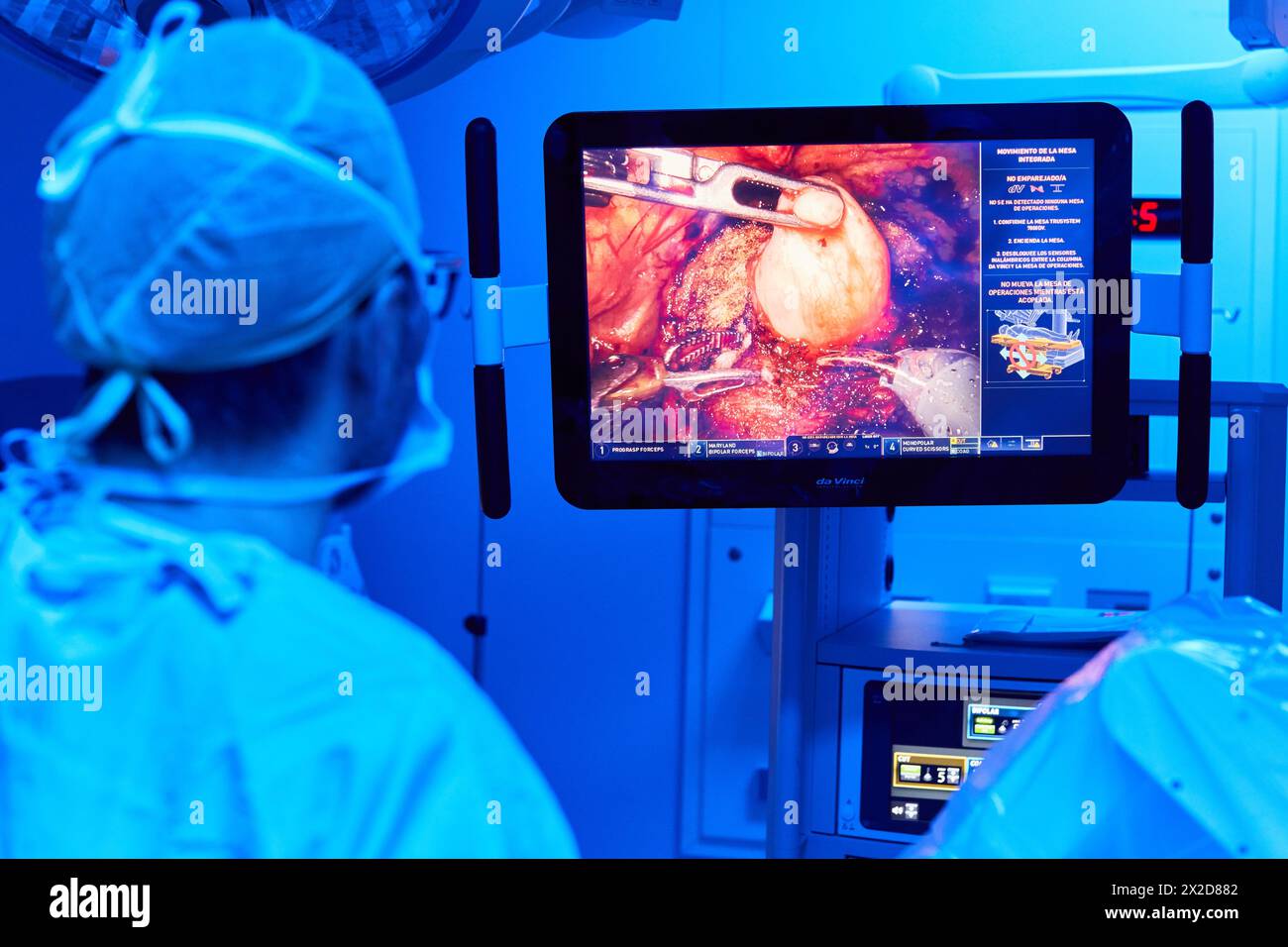 Traitement chirurgical du cancer de la prostate, prostatectomie radicale, robot chirurgical Da Vinci, équipe de chirurgiens des docteurs Madina & Azparren, Urologie, chirurgie Banque D'Images