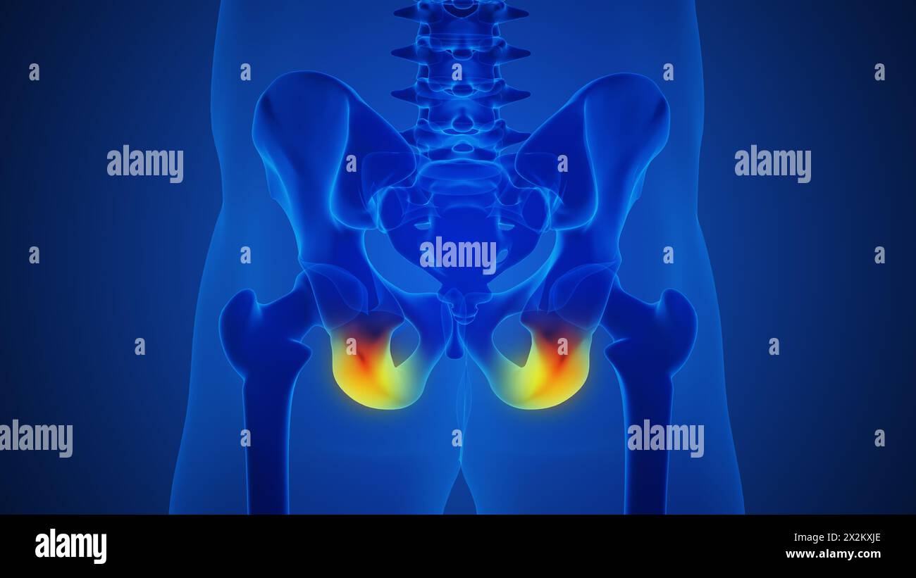 Squelette humain et douleur douloureuse des articulations de la hanche Banque D'Images