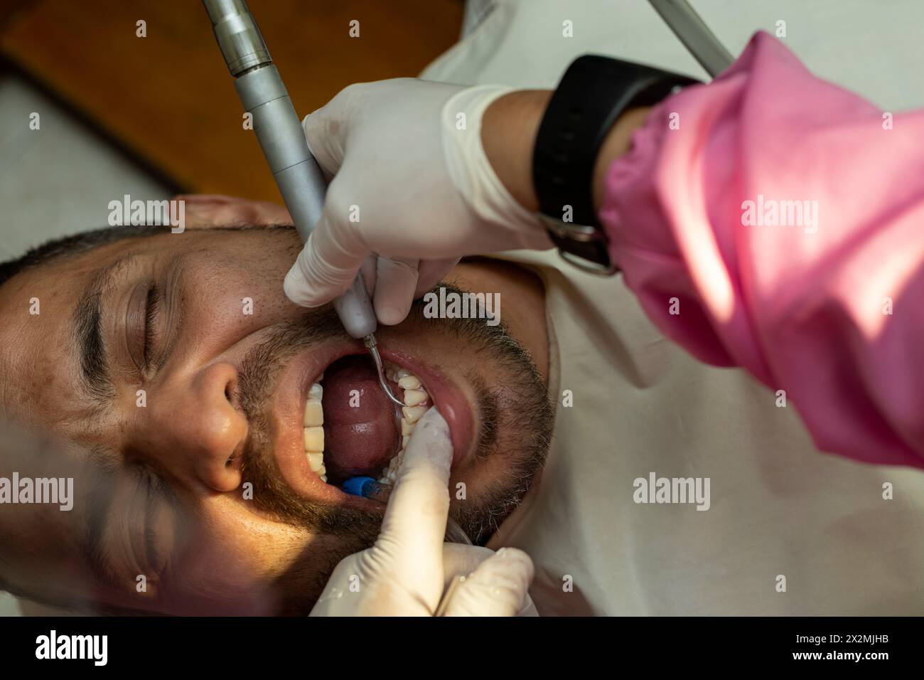 L'homme adulte latin subit une procédure de nettoyage des dents ultrasonique machine pour enlever le calcul dentaire de ses dents. Banque D'Images