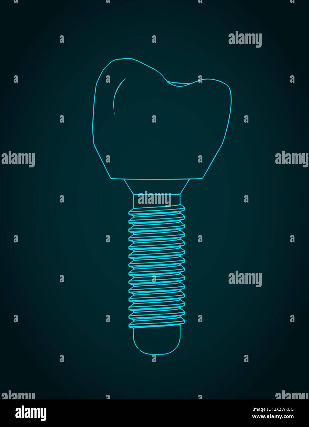 Illustration vectorielle stylisée du plan de prothèse dentaire Illustration de Vecteur