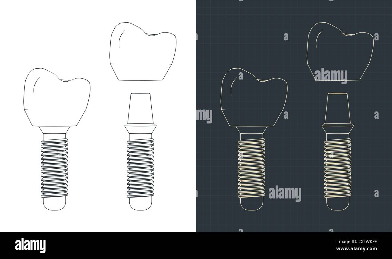 Illustrations vectorielles stylisées de plans de prothèse dentaire Illustration de Vecteur