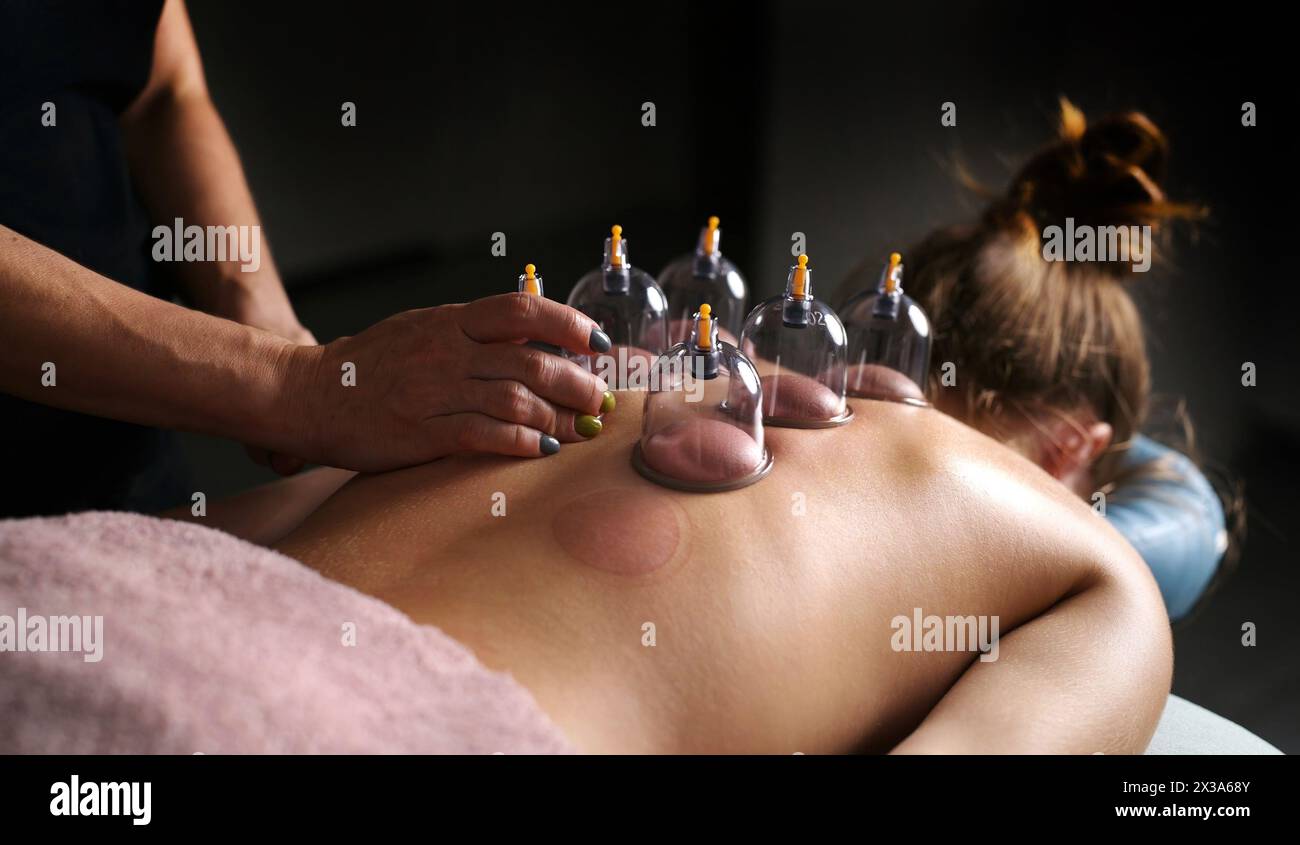 Masseur thérapeute professionnel faisant des procédures avec Une tasse à vide pour la ligne jeune femme sur Une table de massage Banque D'Images