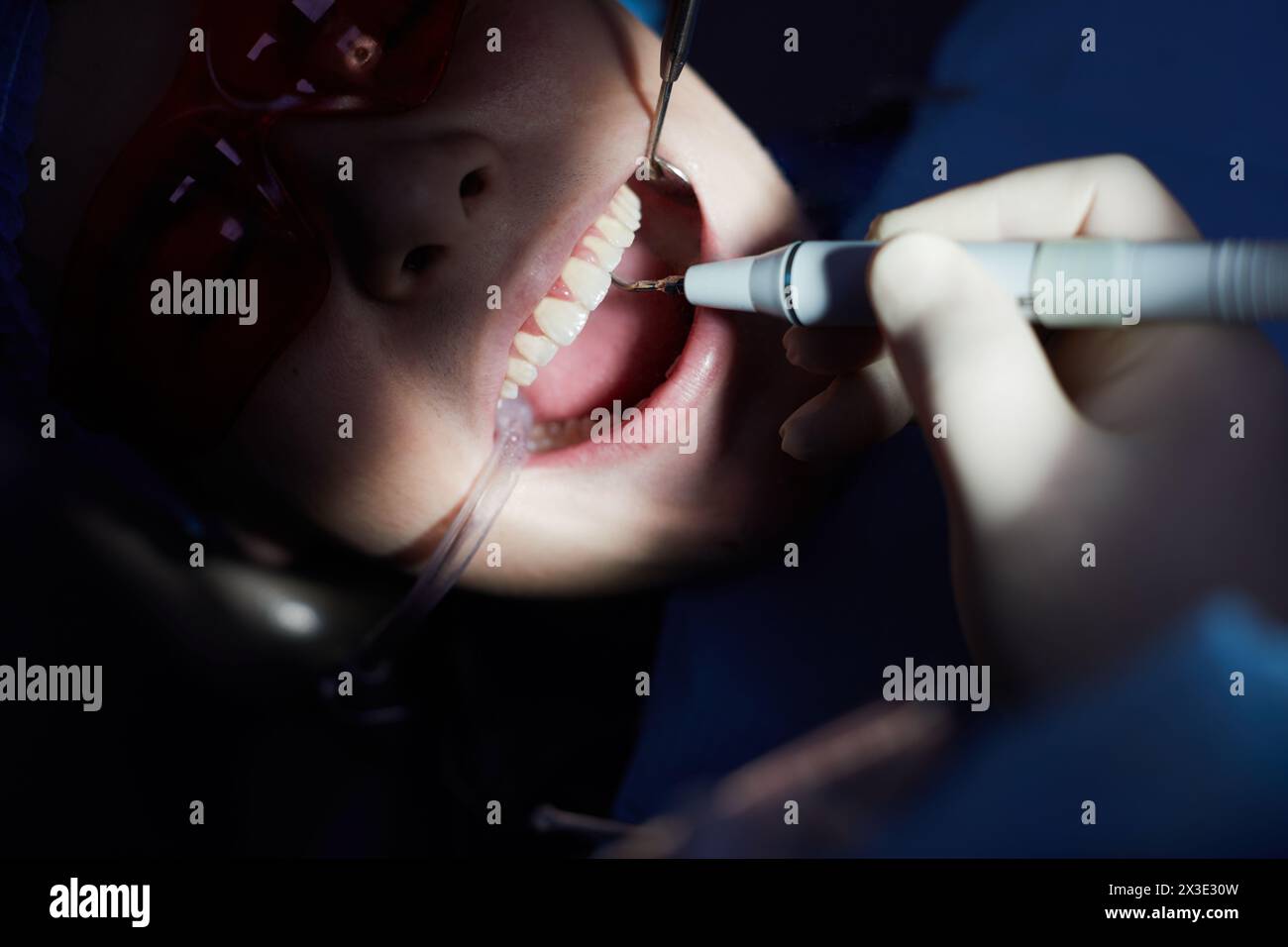 Dentiste fait le nettoyage ultrasonique des dents au patient en utilisant des outils spéciaux dans la clinique dentaire. Banque D'Images