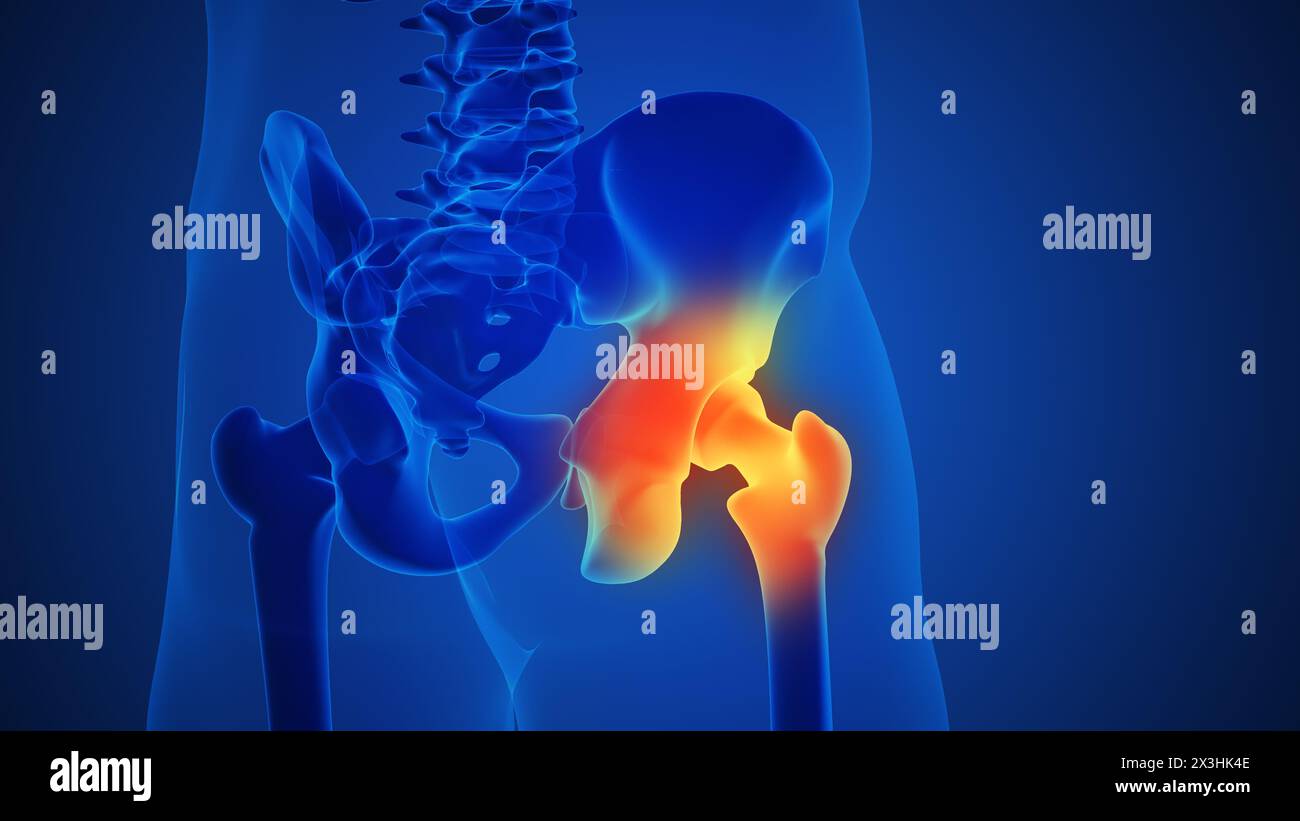 Articulation de la hanche douloureuse avec fond bleu Banque D'Images