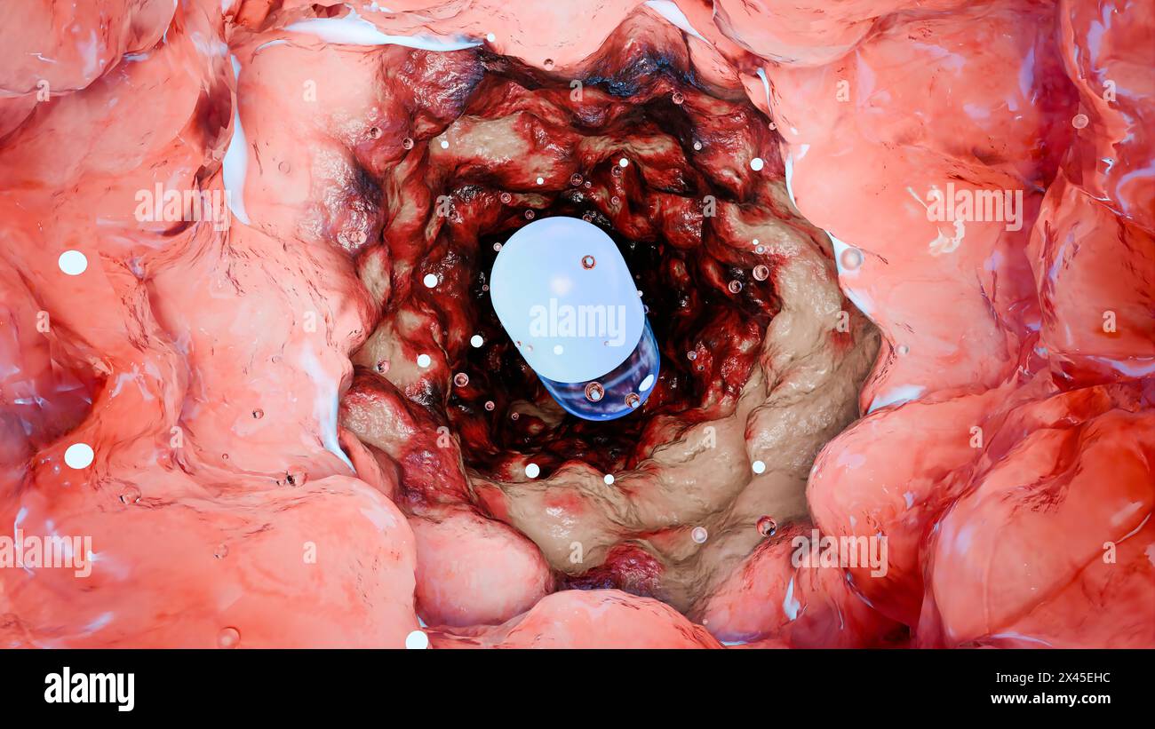 Les probiotiques dans le tractus intestinal. endoscopie par l'intestin. Microbiote, pilule capsule avec des vitamines pour le système digestif, traitement des douleurs d'estomac, rouge Banque D'Images