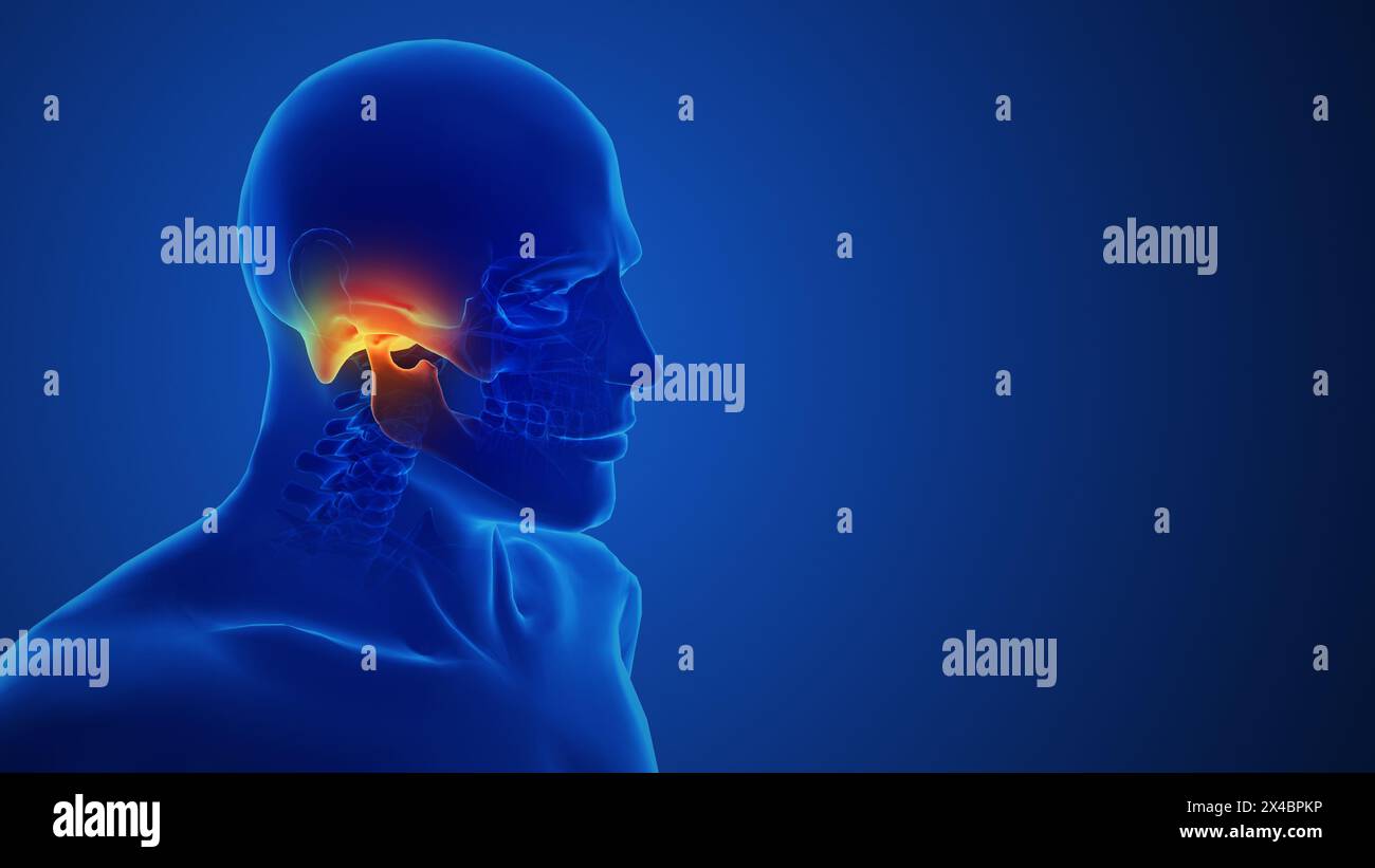 Sciatique rachis et douleur nerveuse concept médical Banque D'Images