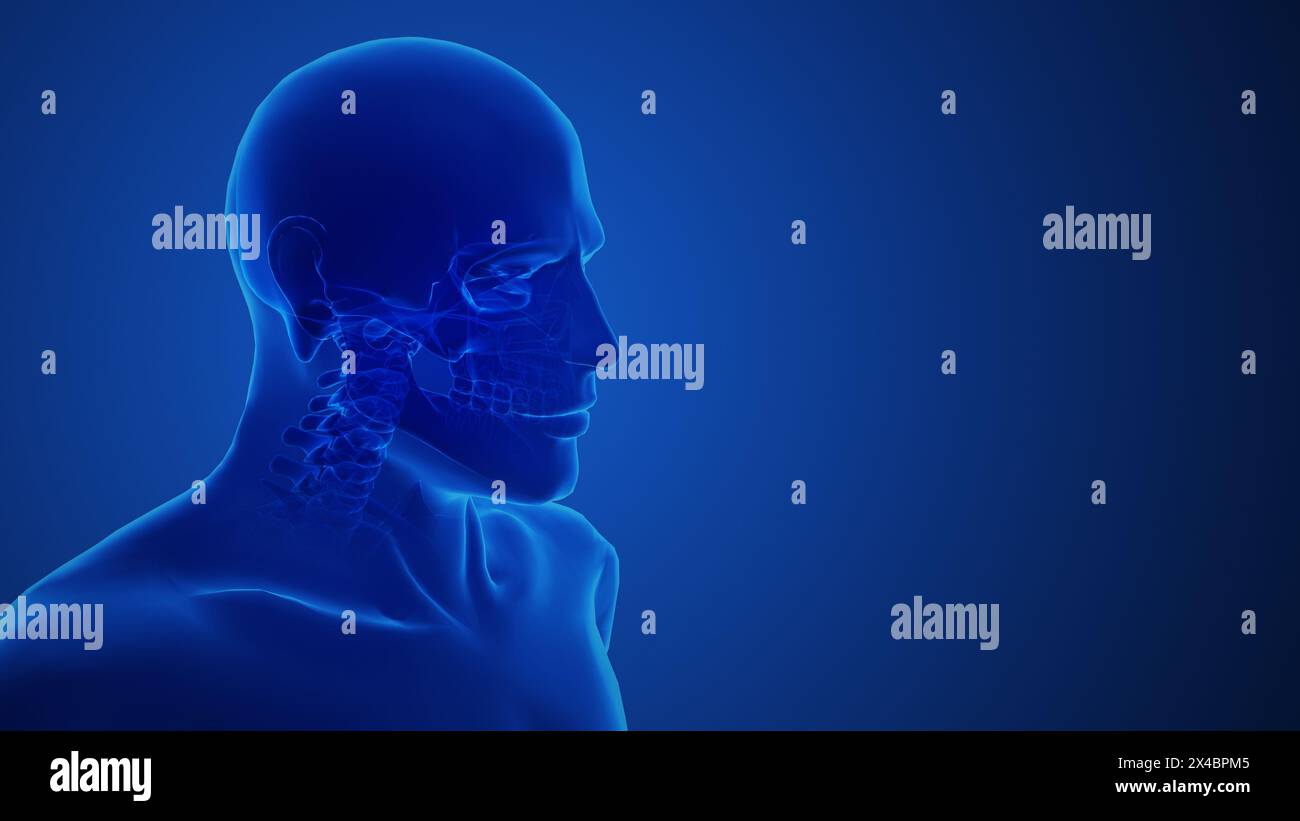 Sciatique rachis et douleur nerveuse concept médical Banque D'Images
