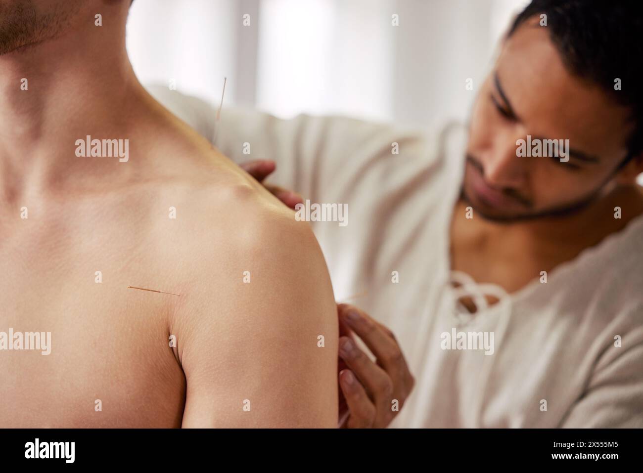 Acupuncture, thérapeute et homme dans le traitement pour la guérison des muscles du corps ou le soulagement des maux de dos. Aide, patient et physiothérapie avec aiguilletage sec à Banque D'Images