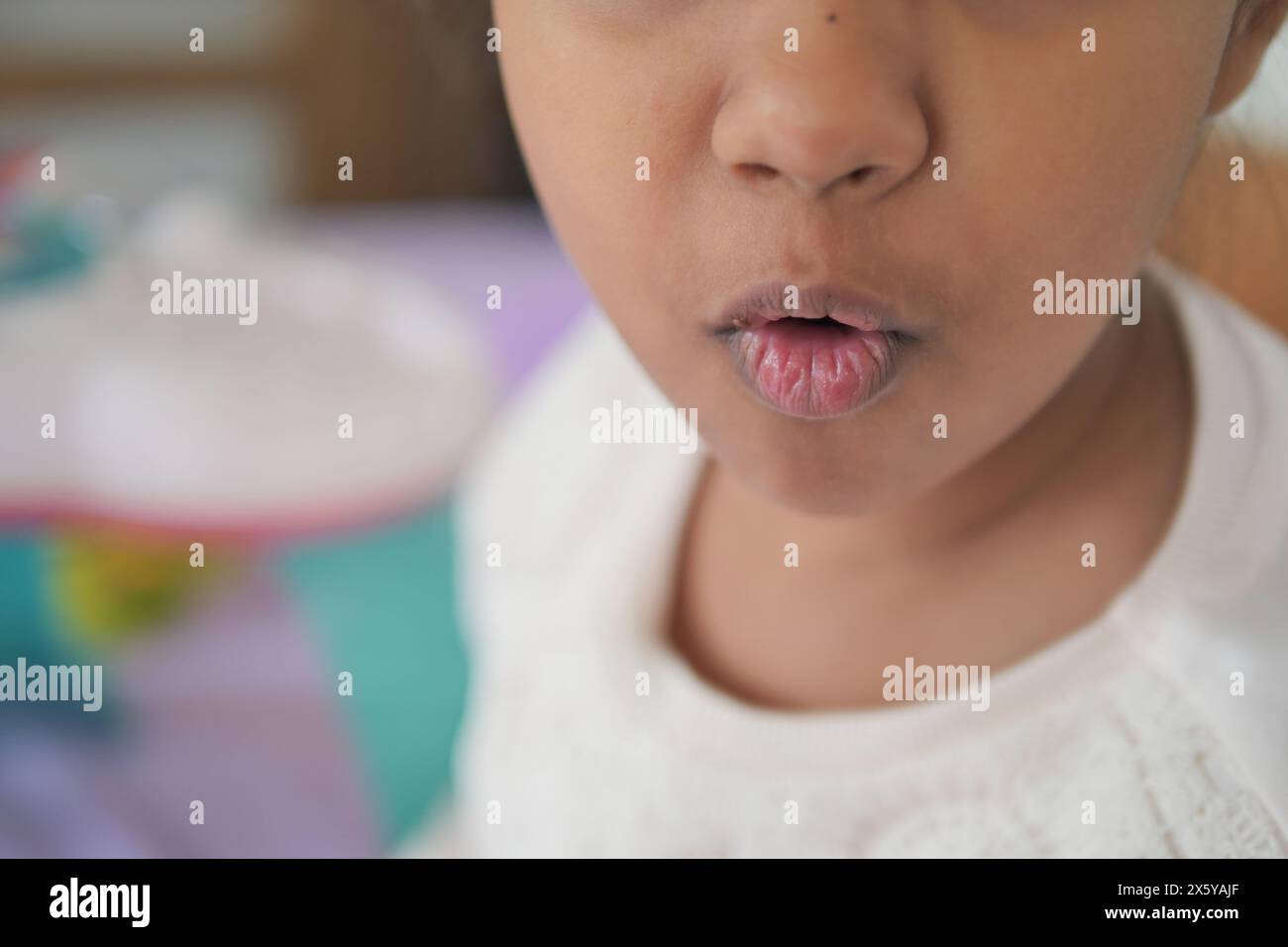 gros plan de la lèvre sèche d'un enfant Banque D'Images