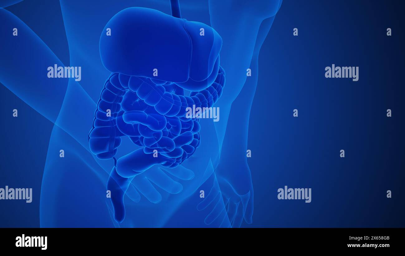 L'anatomie de la douleur de l'inflammation de l'appendice pour un concept médical Banque D'Images